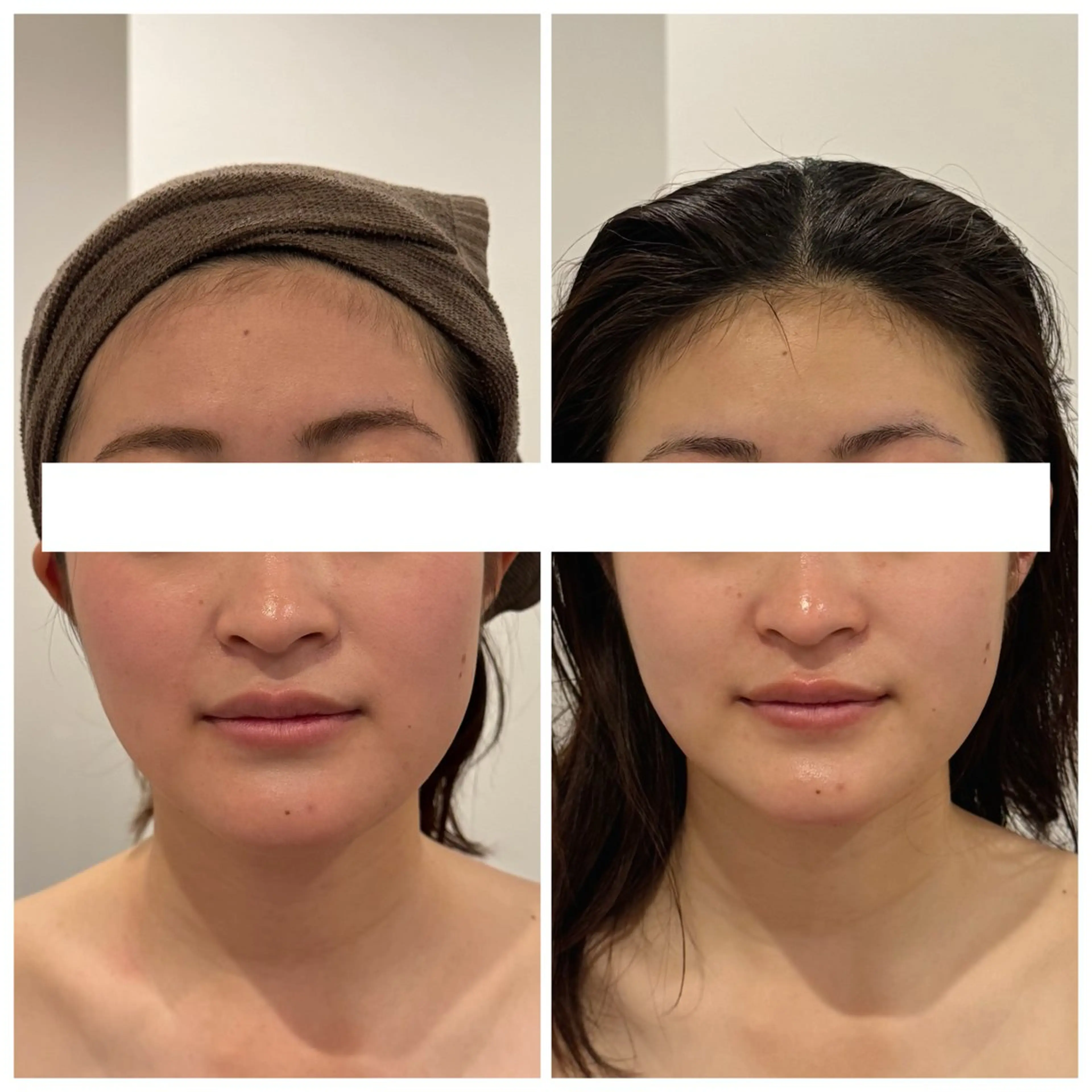 エステ リラク 小顔EX心斎橋 REVIハーブのエステ・リラクイメージ