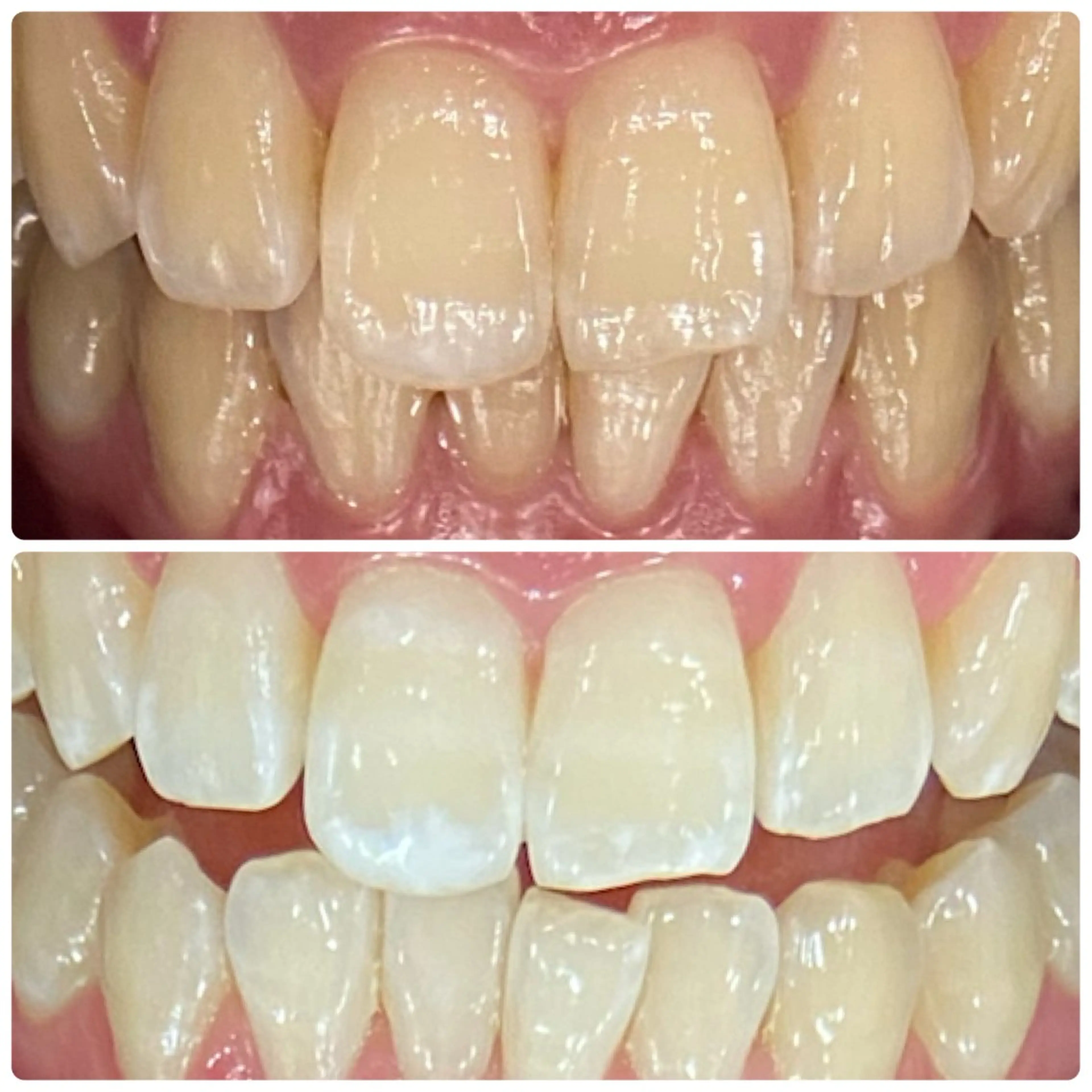 PLATINUM Beauty 横浜店所属・ホワイトニングルーム 横浜店のその他イメージ