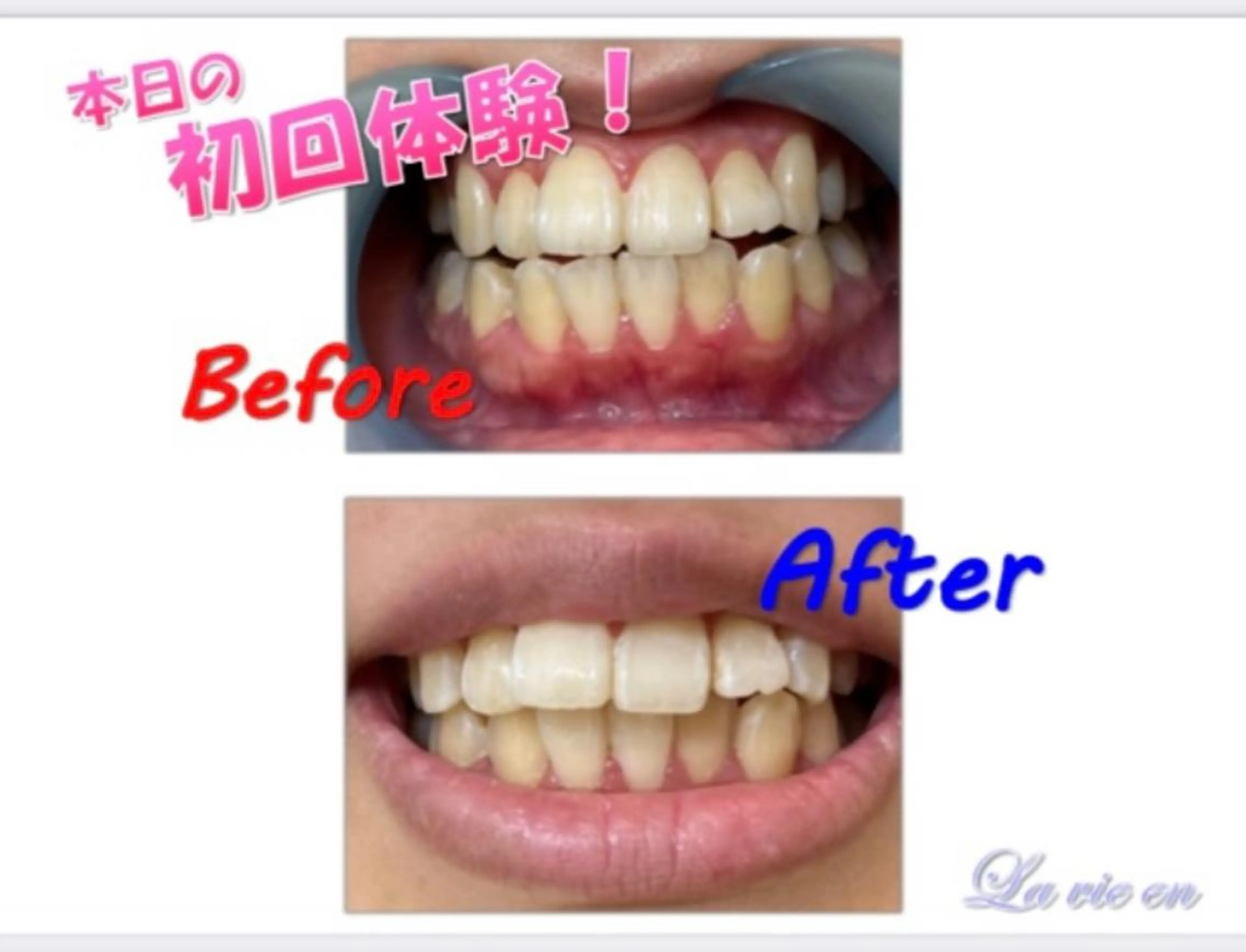 その他 ホワイトニングサロン La vie enのその他イメージ