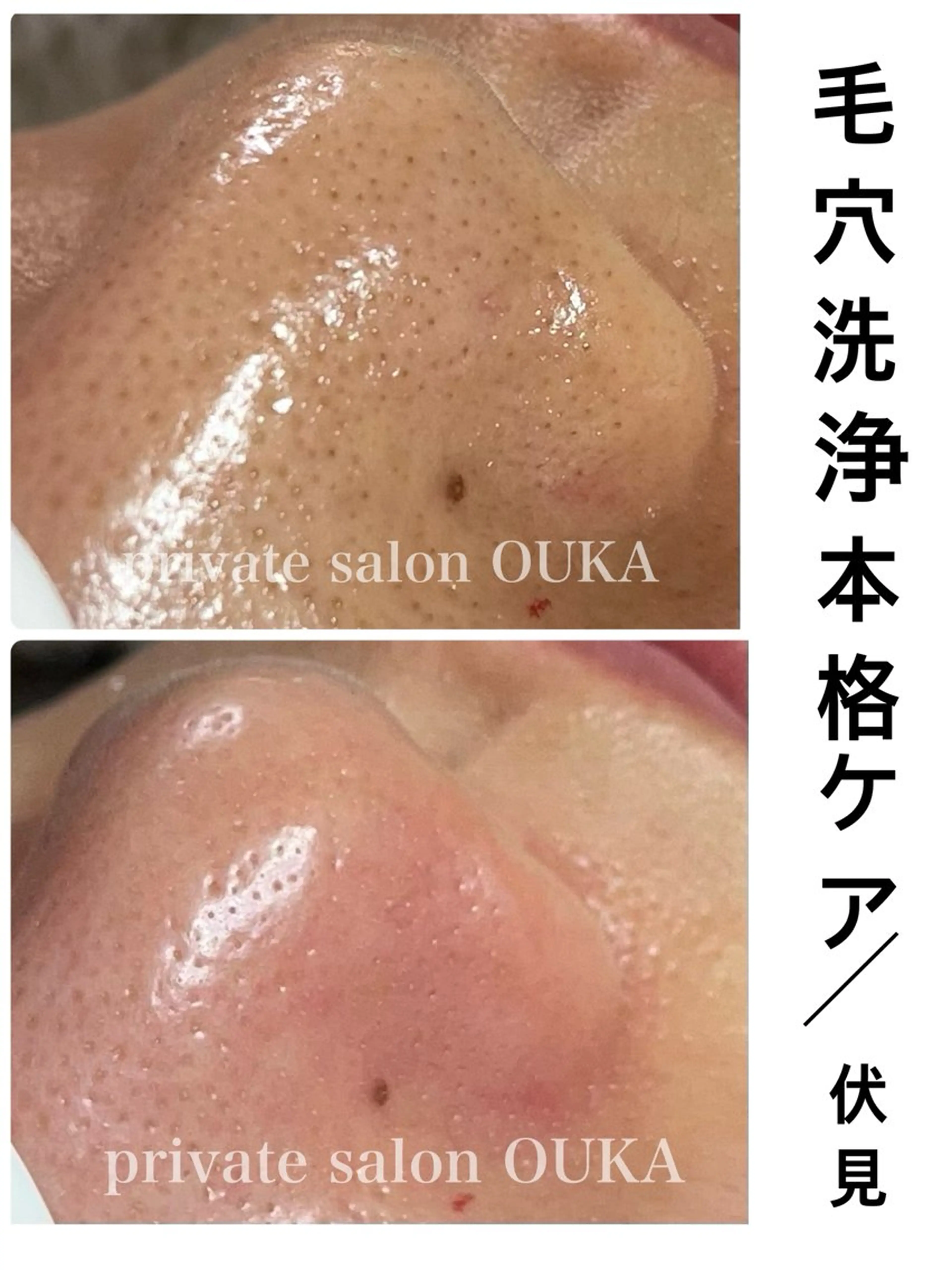 OUKA脱毛 毛穴ケアフェイシャルのエステ・リラクイメージ