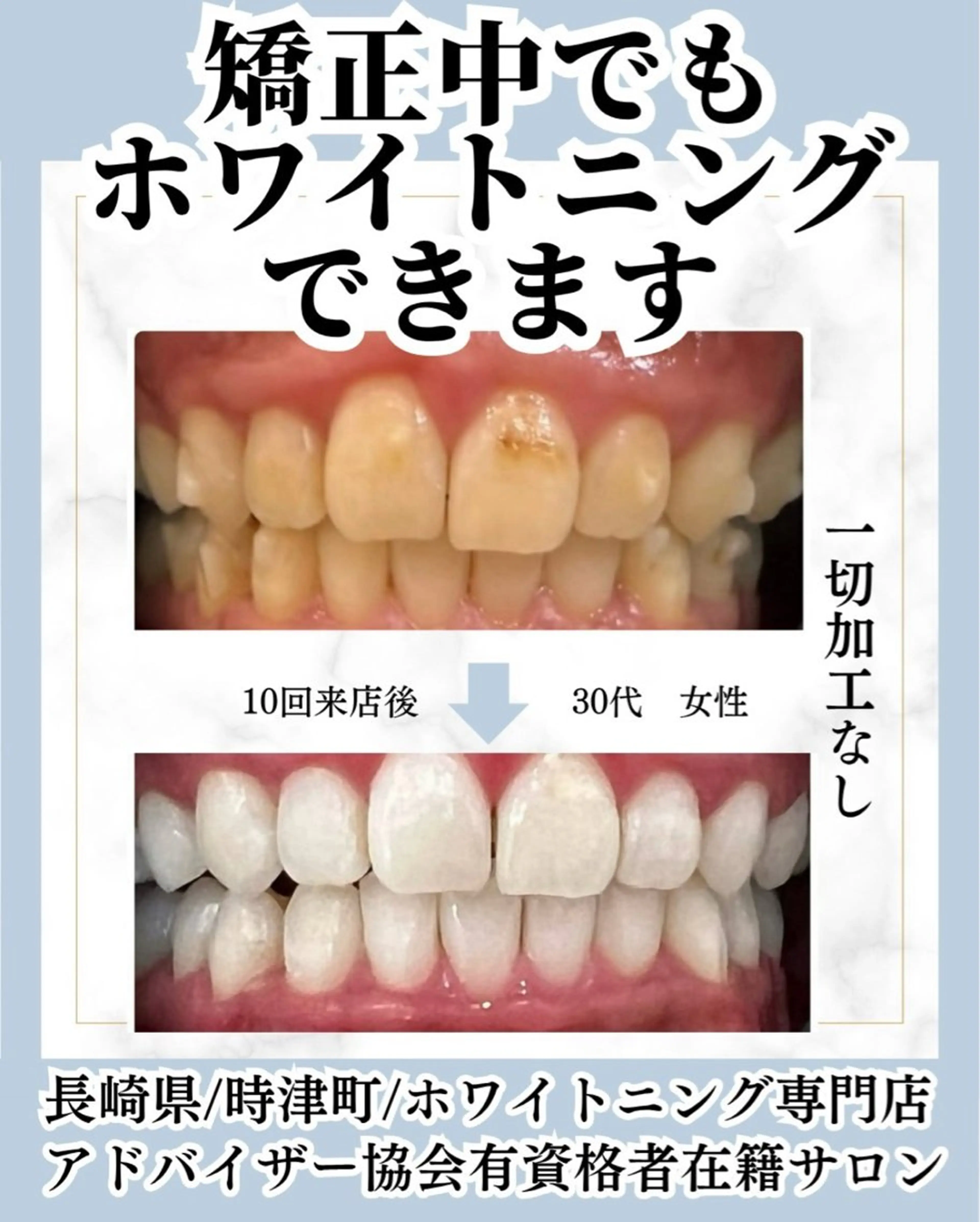 ホワイトニング ショップ長崎時津店のその他イメージ