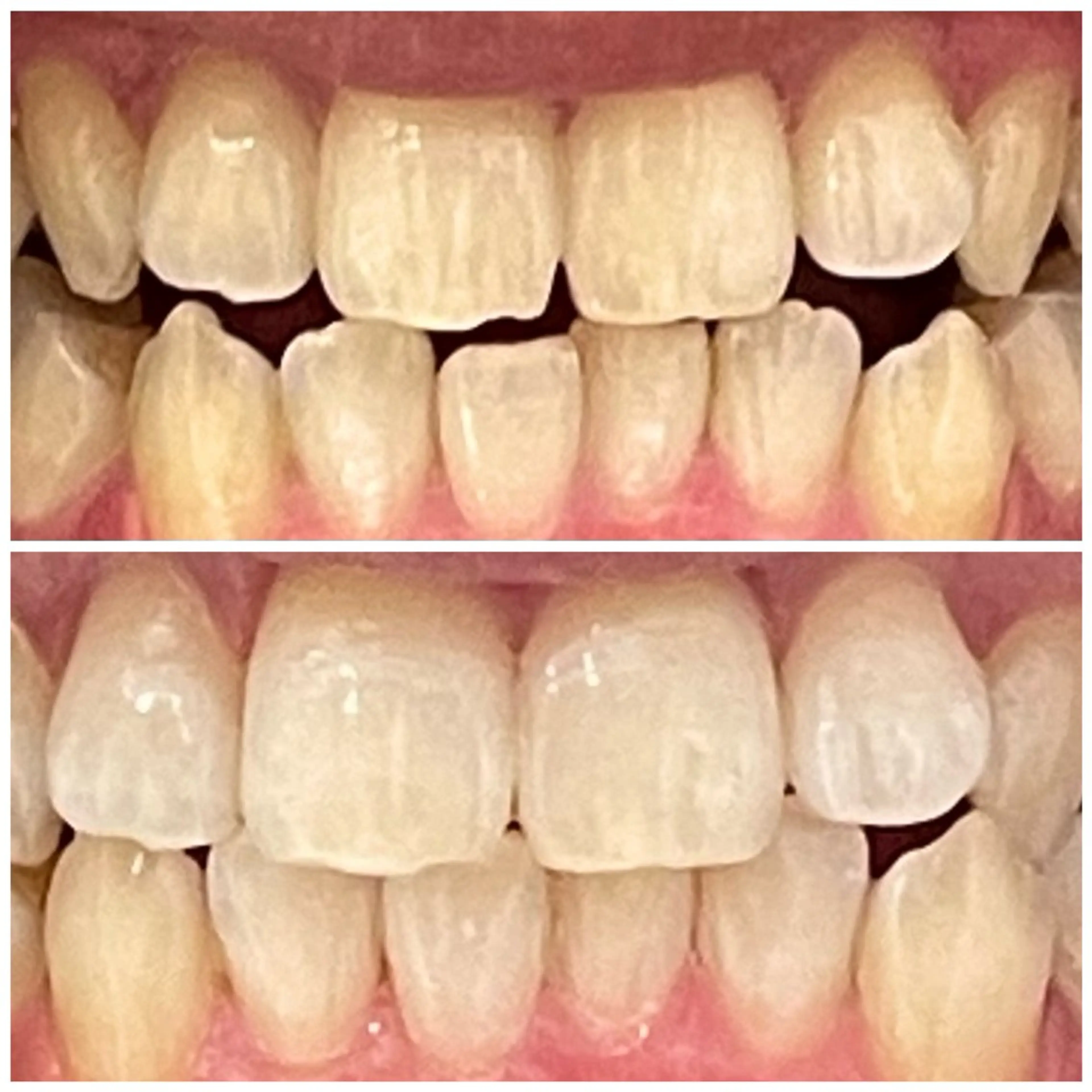 アイブロウ DIAMOND BEAUYのその他イメージ