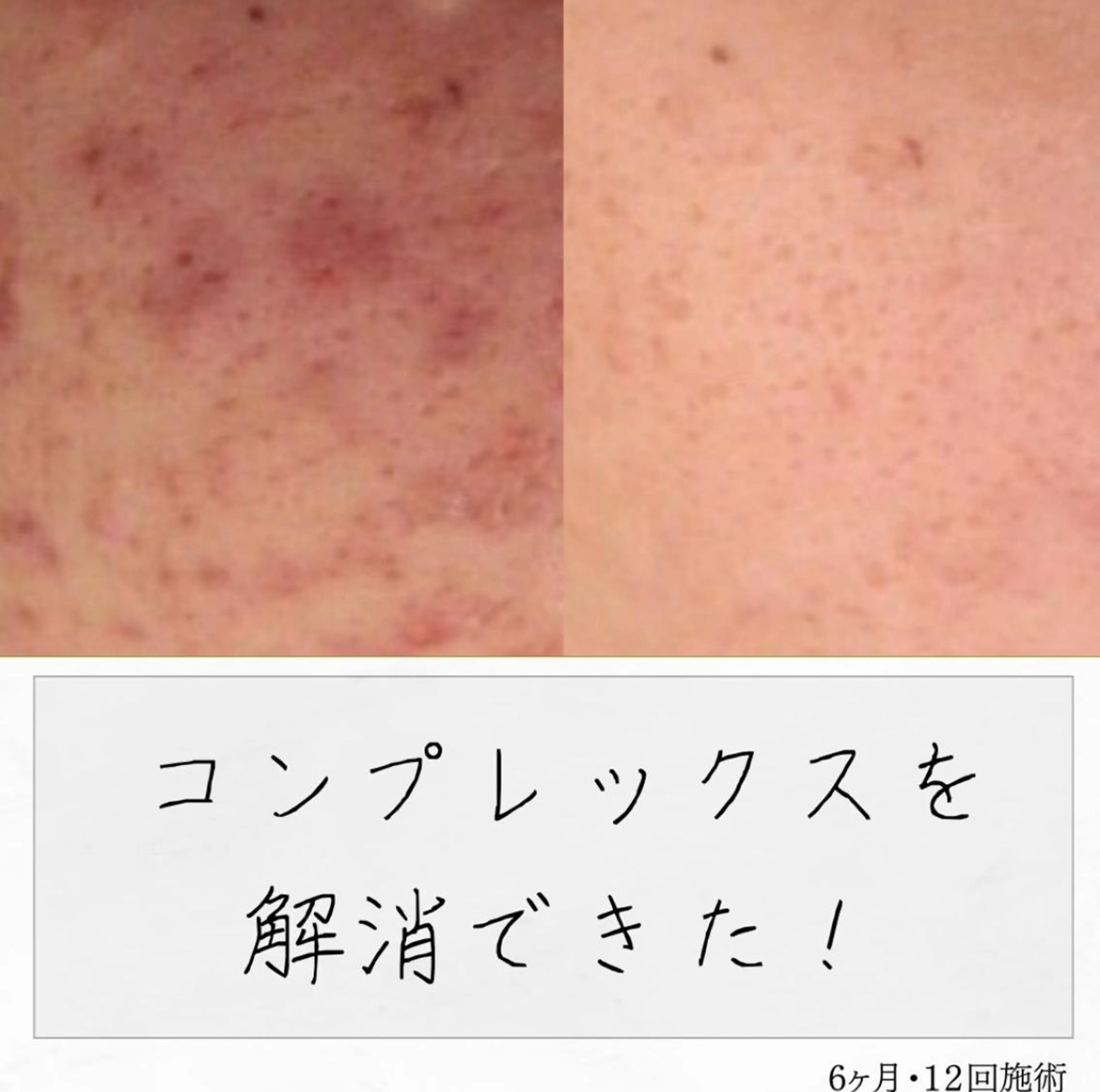 ニキビ経験者が施術 する専門サロン🌻のエステ・リラクイメージ
