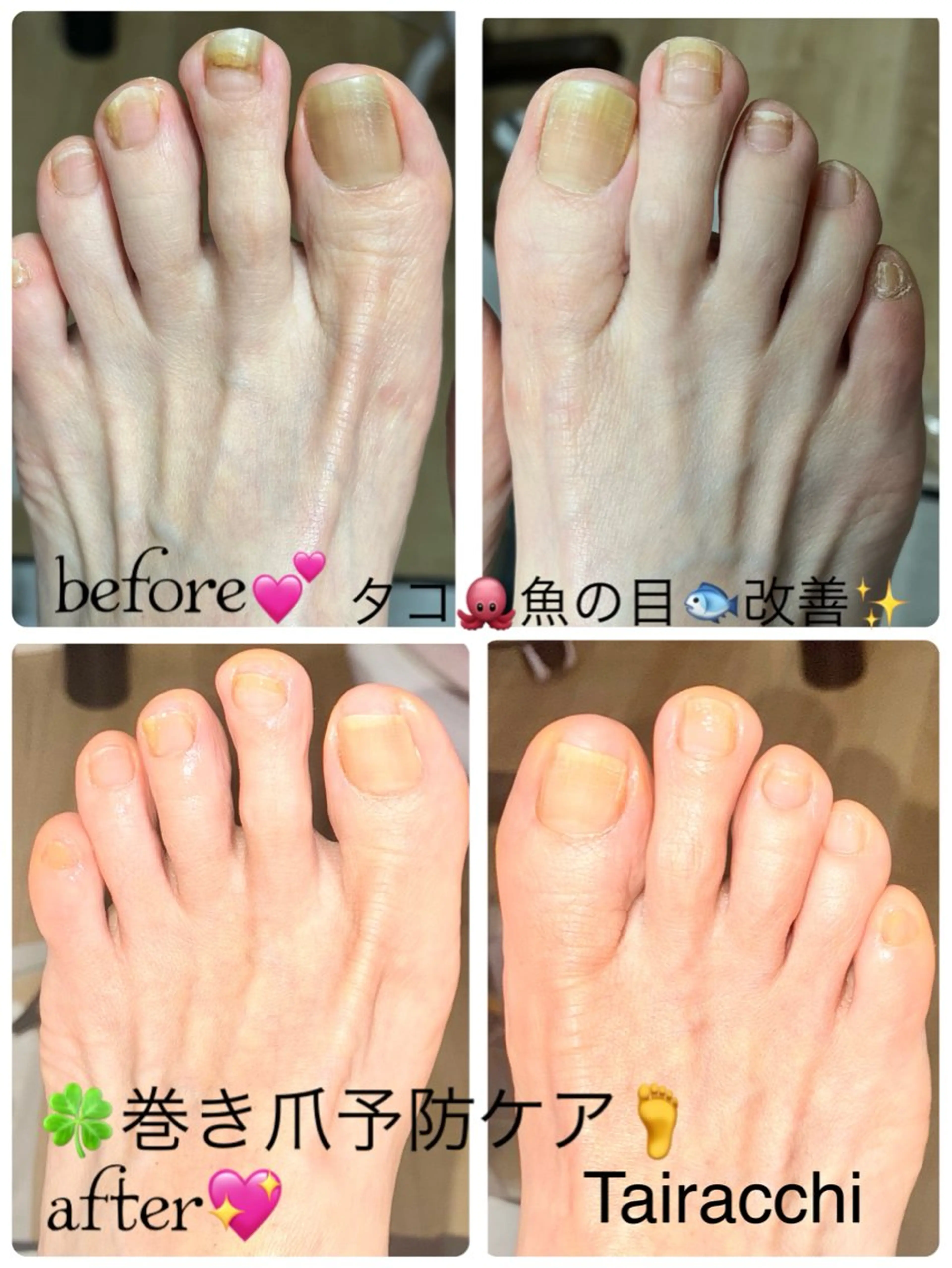 ネイル フットネイル フットネイル Tairacchi タイラッチのネイルデザイン