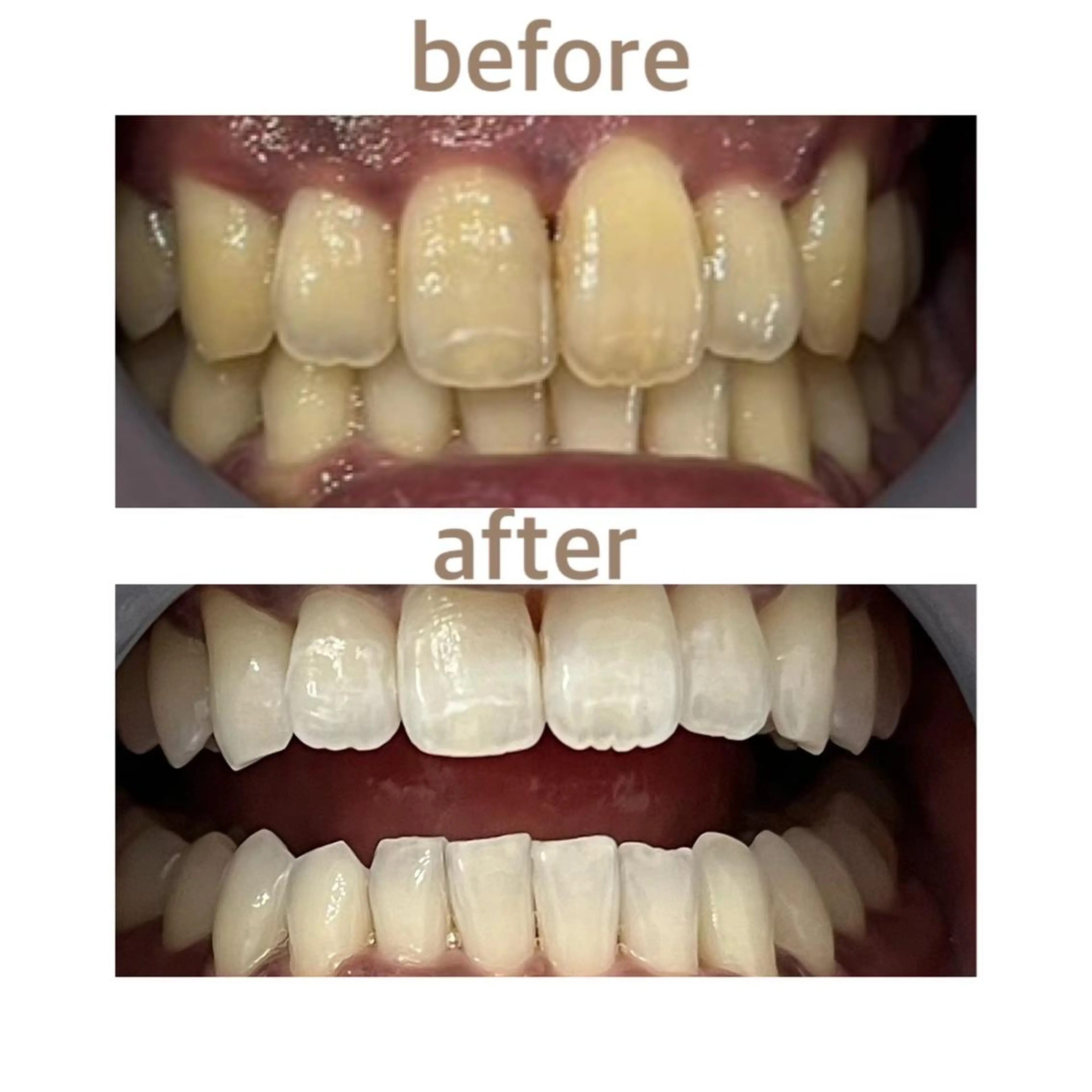 メンズ エステ リラク ホワイトニング ショップ船橋店🦷のエステ・リラクイメージ