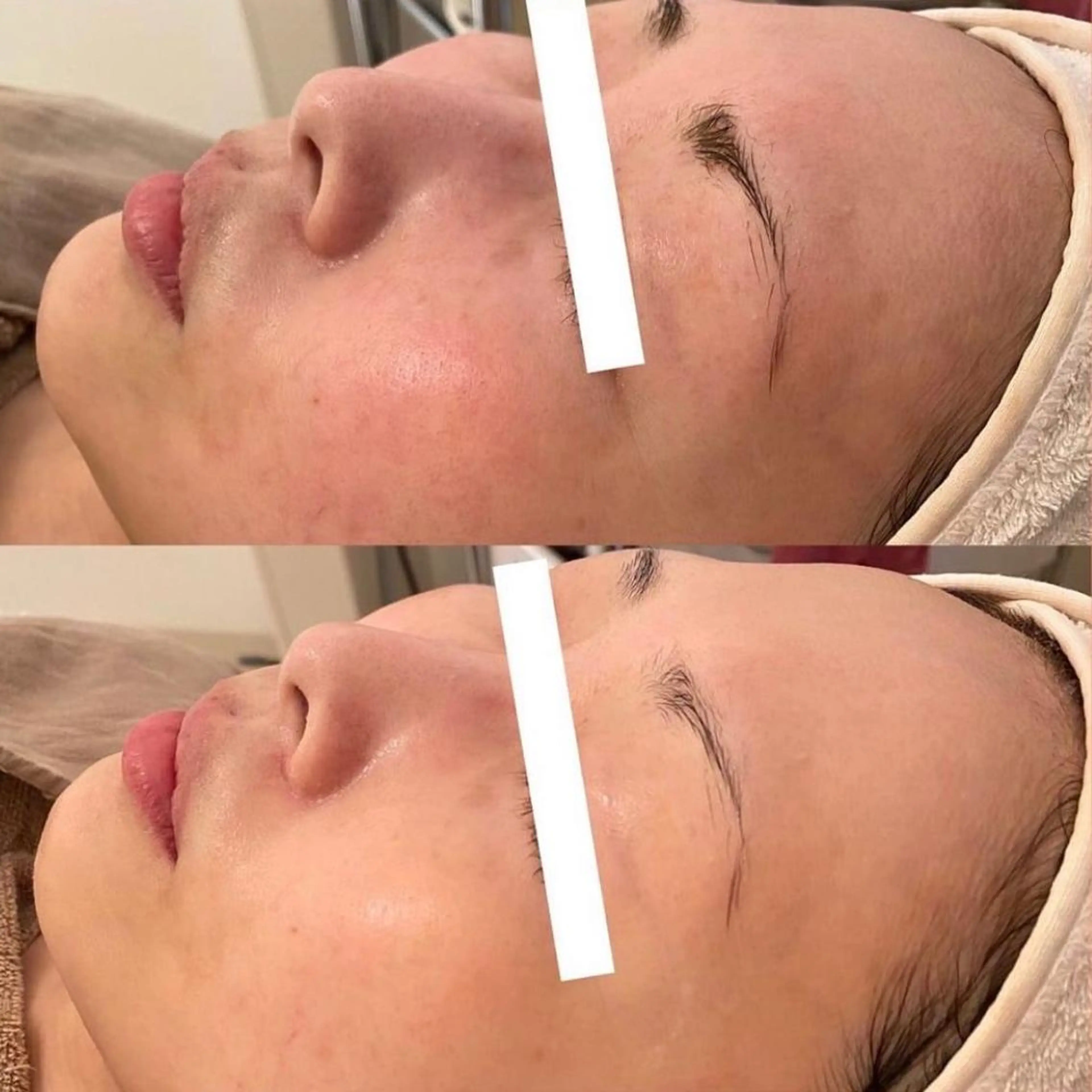 エステ ララ/ハーブ メゾンリュバンのエステ・リラクイメージ