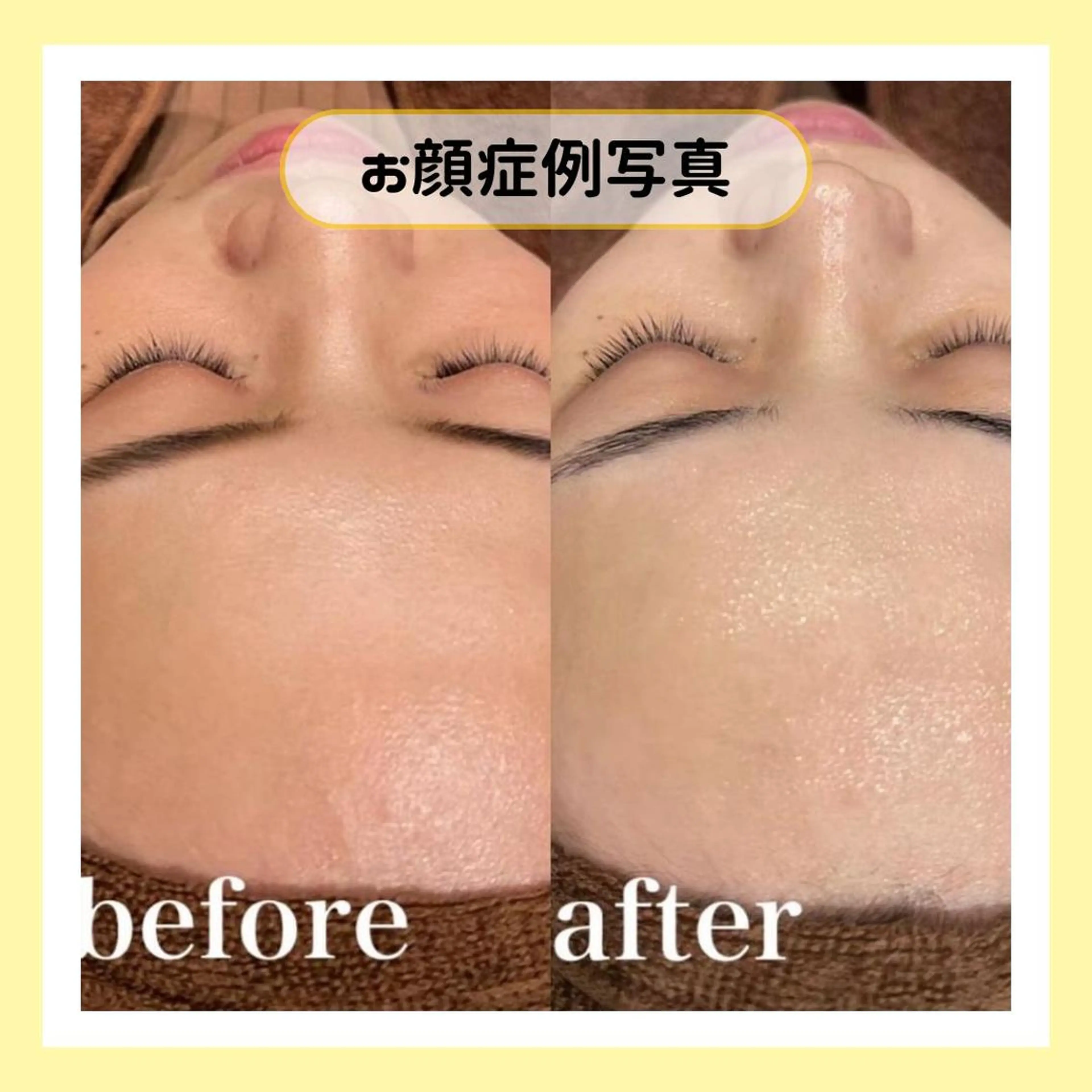 金山/脱毛/美肌 ULULUのエステ・リラクイメージ