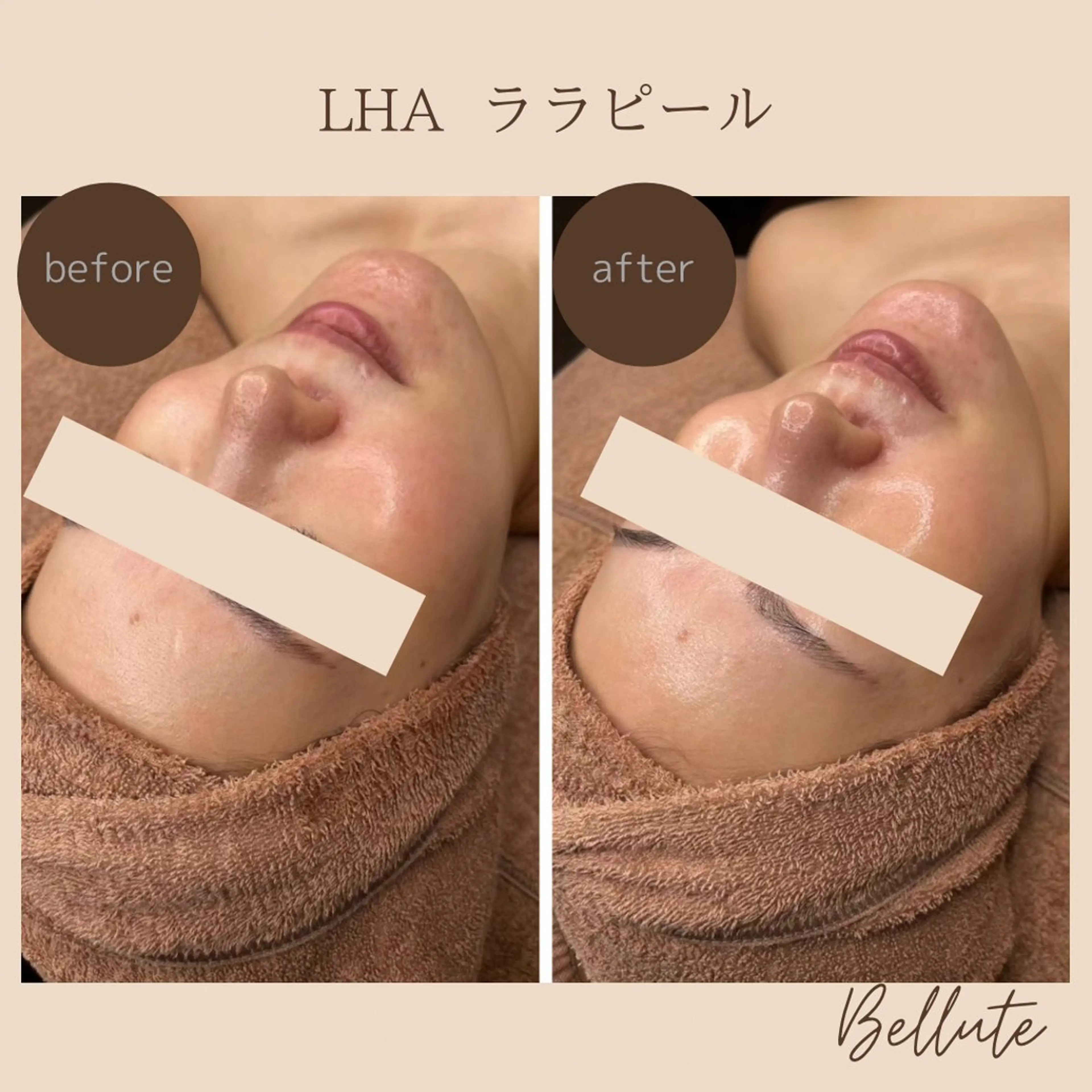 エステ ピーリング専門店 Belluteのエステ・リラクイメージ
