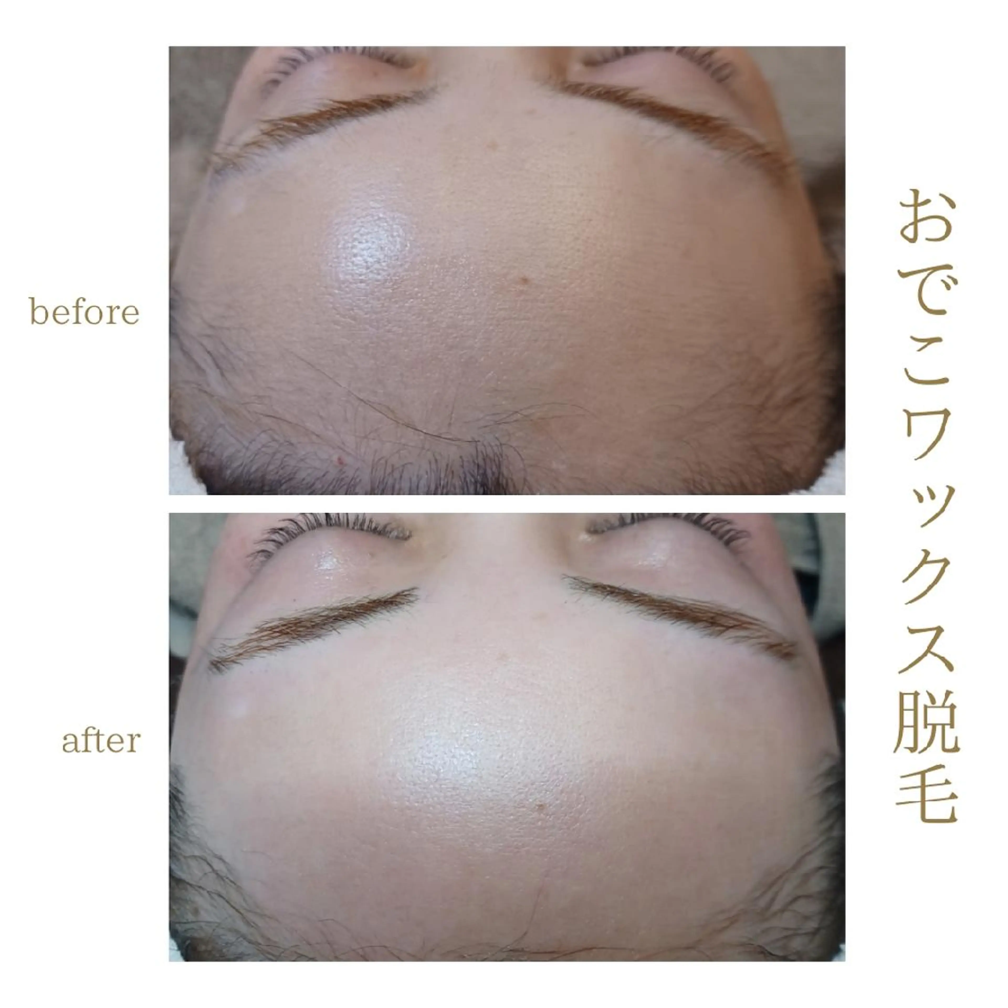 ワックス脱毛専門店 Lutellaのエステ・リラクイメージ