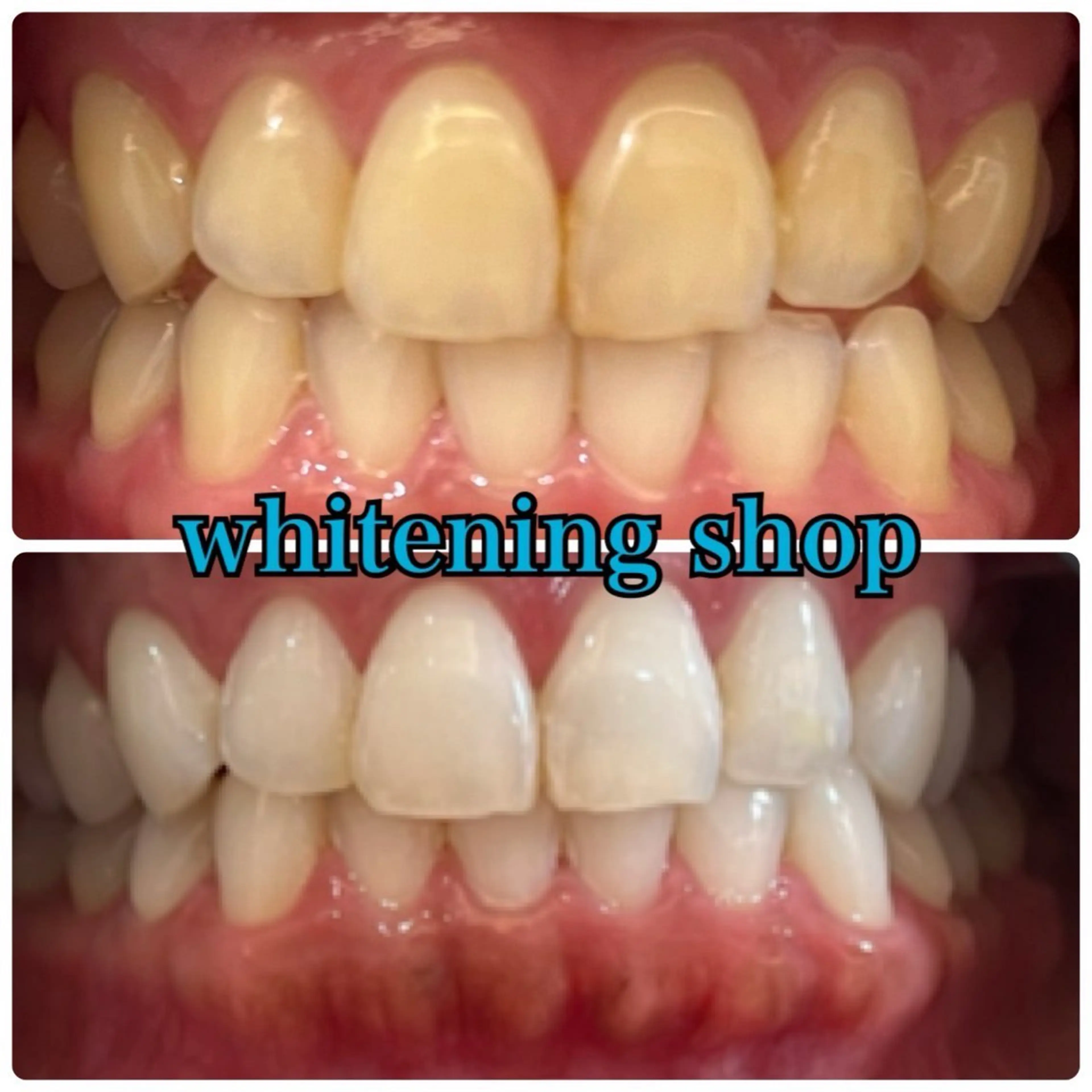 メンズ エステ リラク ホワイトニング ショップ川越店のエステ・リラクイメージ