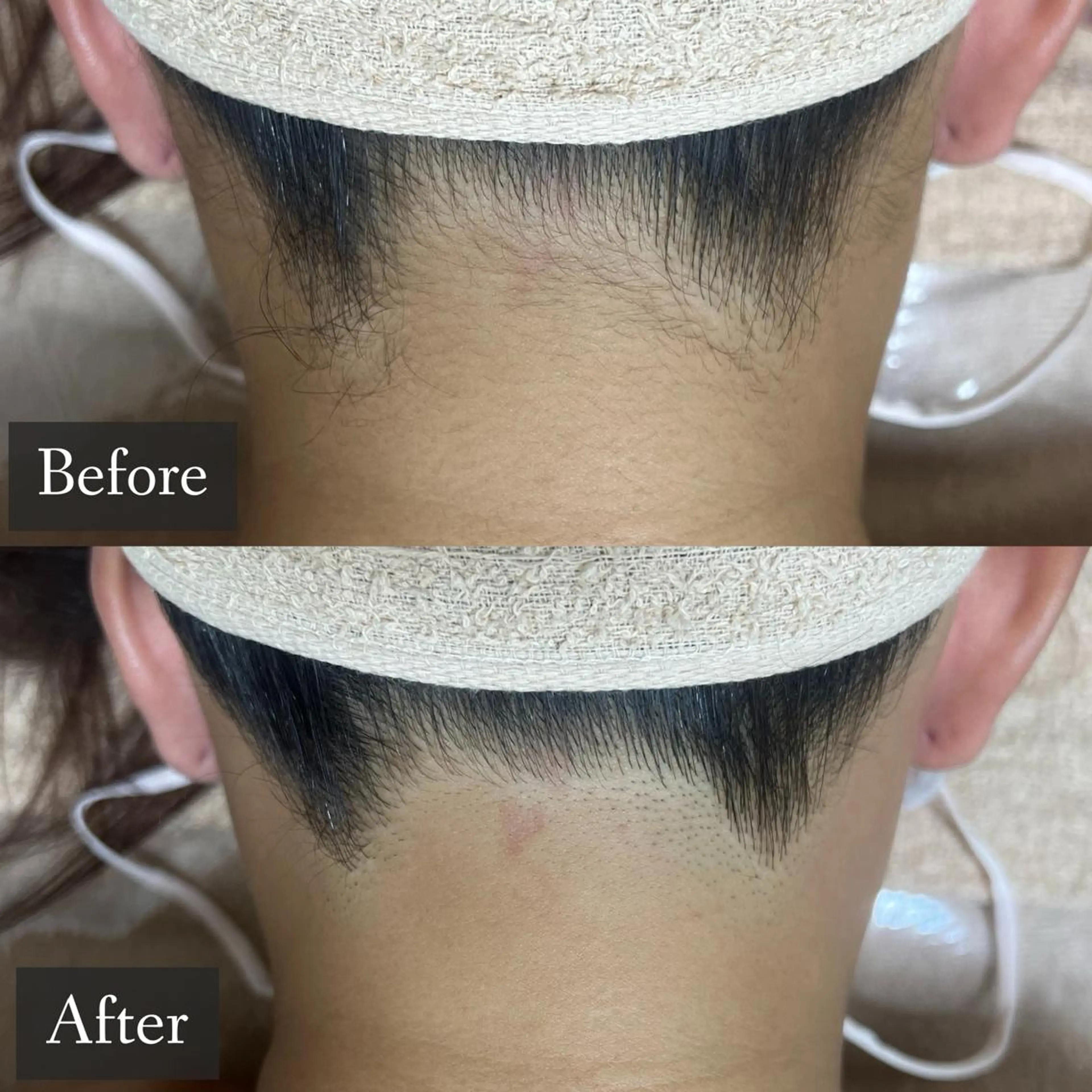 脱毛 脱毛専門サロン BELFINE恵比寿のエステ・リラクイメージ