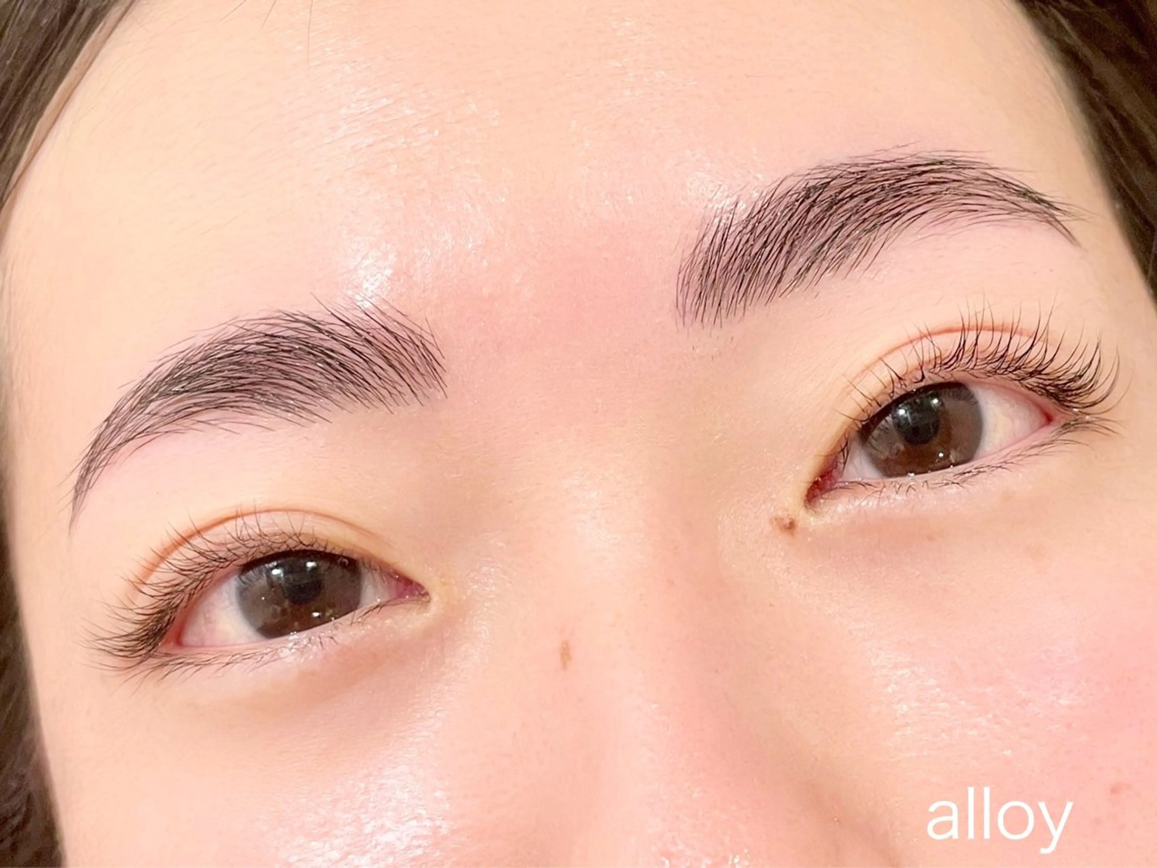 フェイシャルワックス脱毛の写真