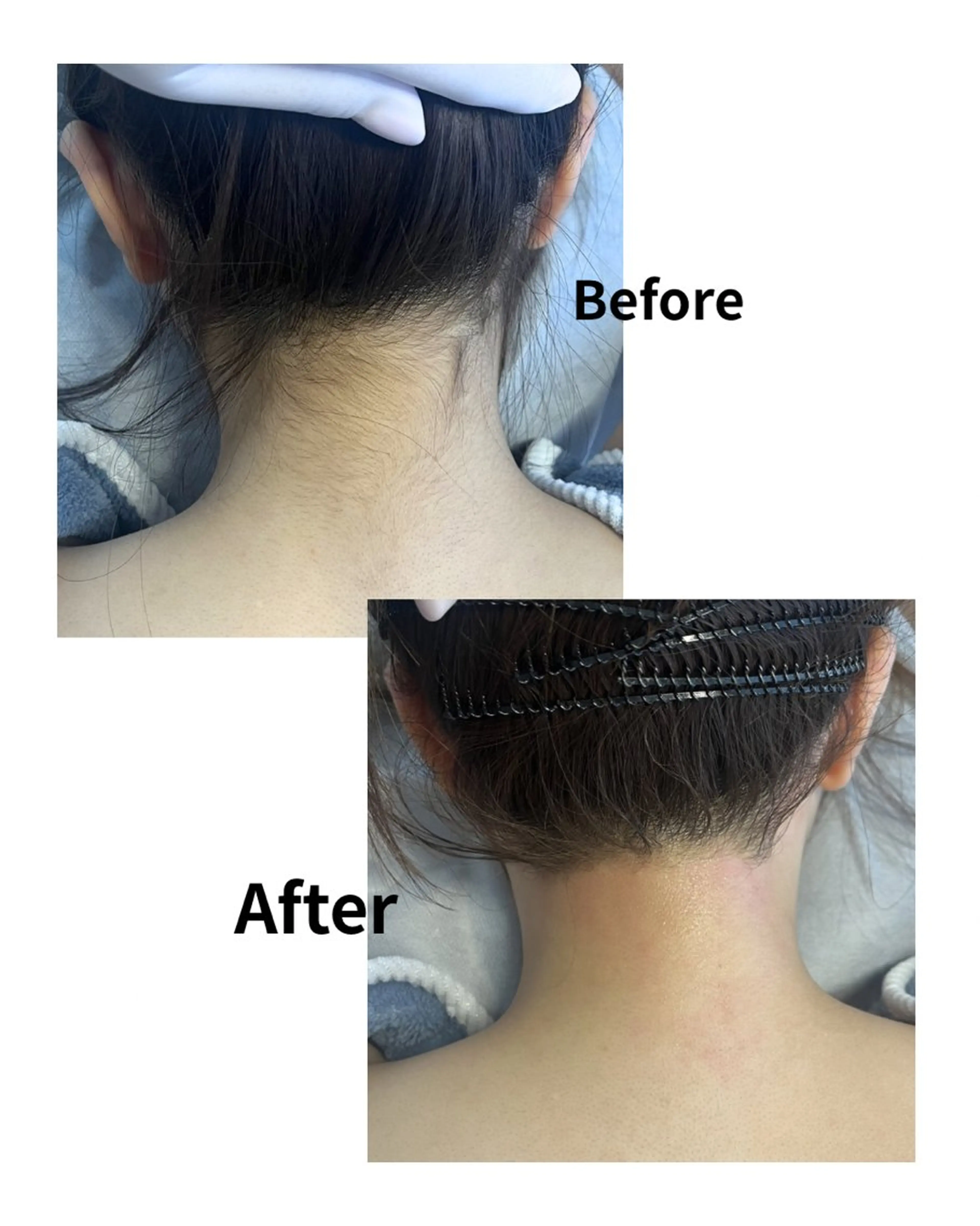 脱毛 MASAMI マサミのエステ・リラクイメージ