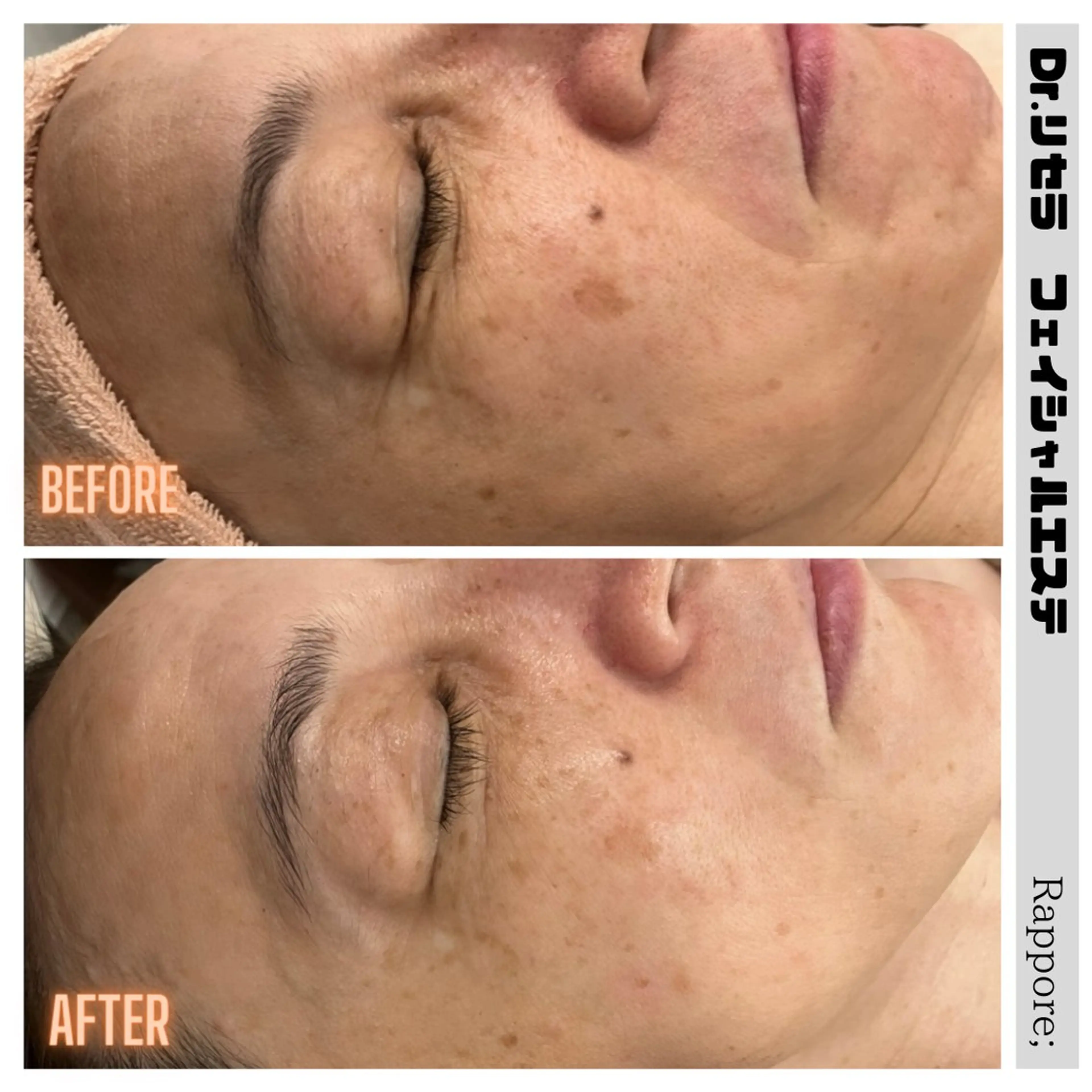 エステ Rappore; 心斎橋　みずきのエステ・リラクイメージ