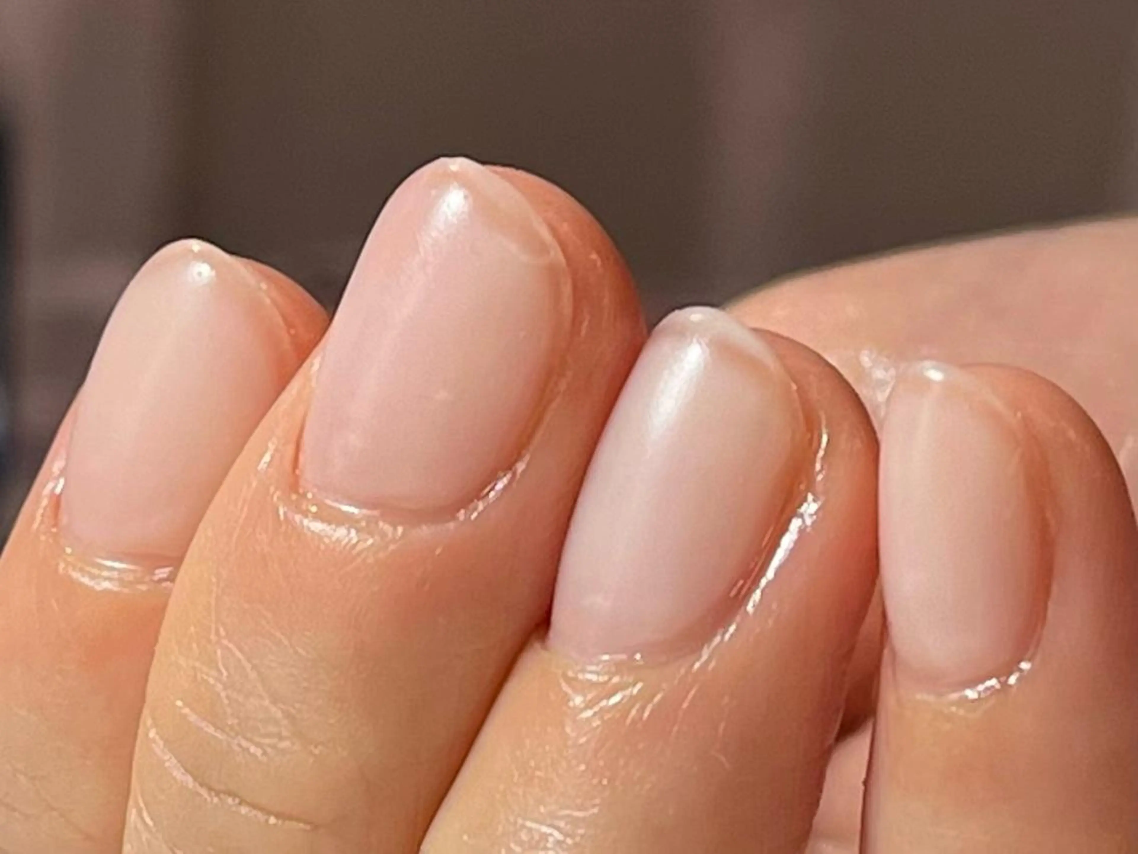 ネイル 自爪育成・巻き爪 補正講師　津蔵のネイルデザイン