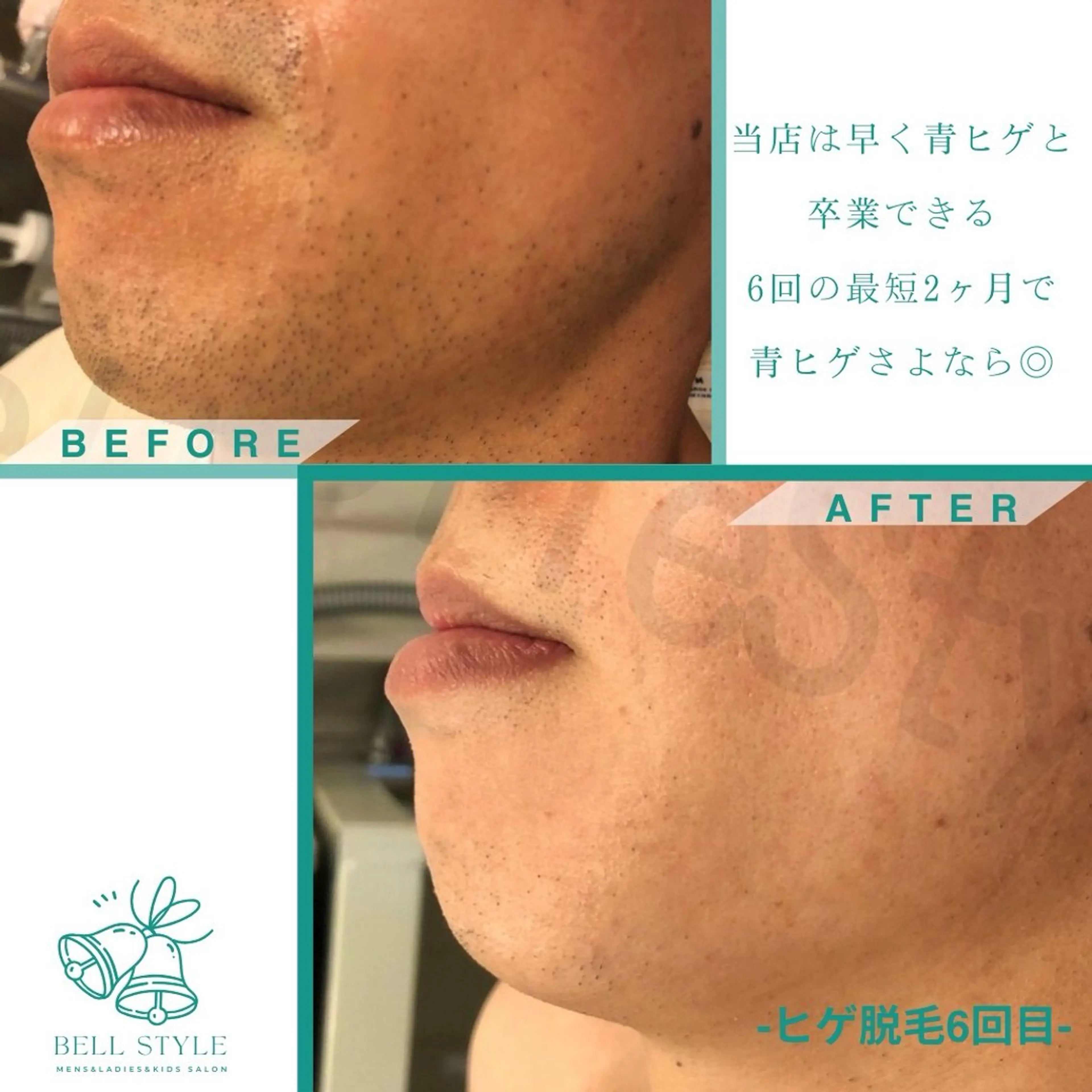 メンズ キッズ 【脱毛・美肌専門】メンズ&レディースサロンBell style所属・【脱毛・美肌専門】 bellstyleのエステ・リラクイメージ