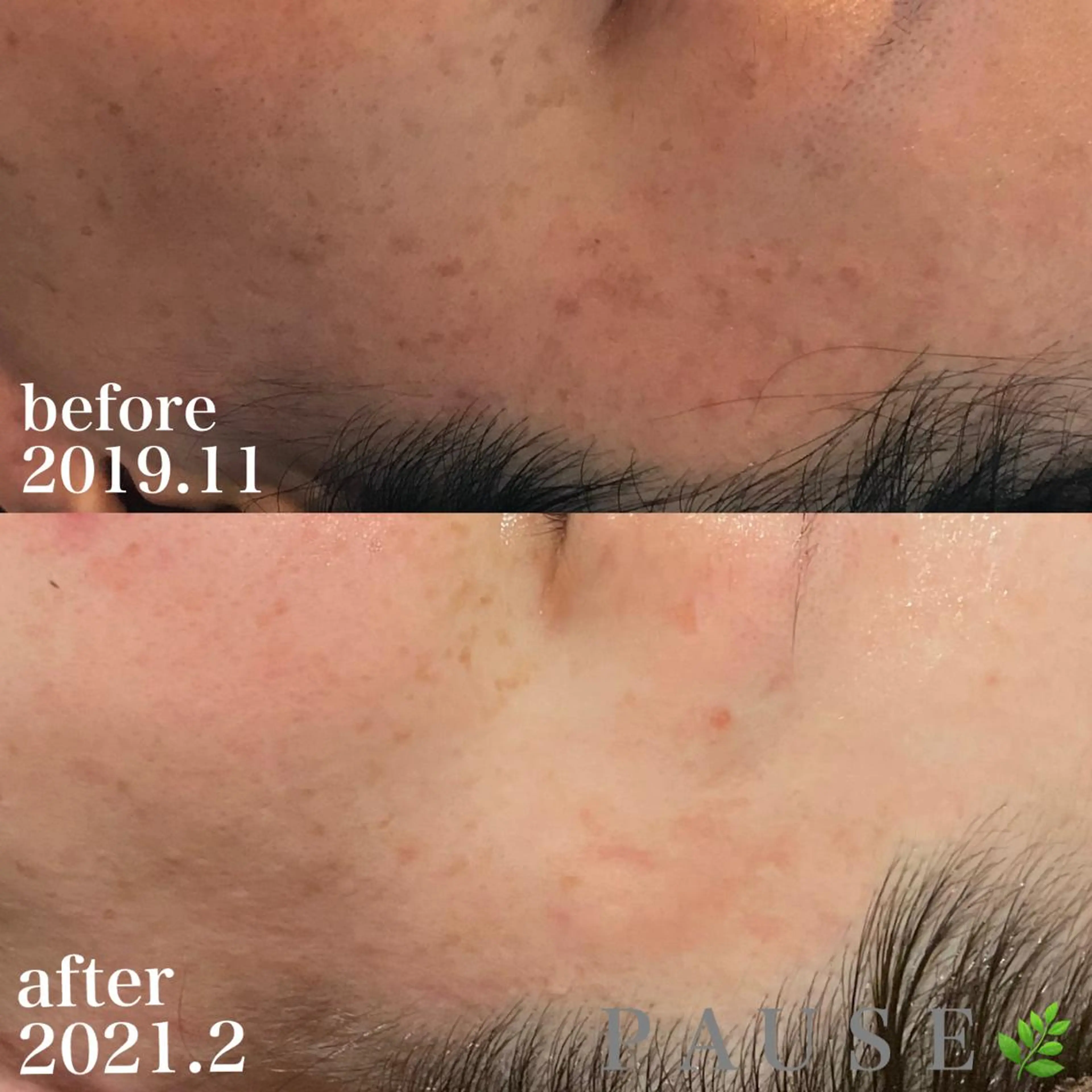 エステ 浜野 恵美のエステ・リラクイメージ