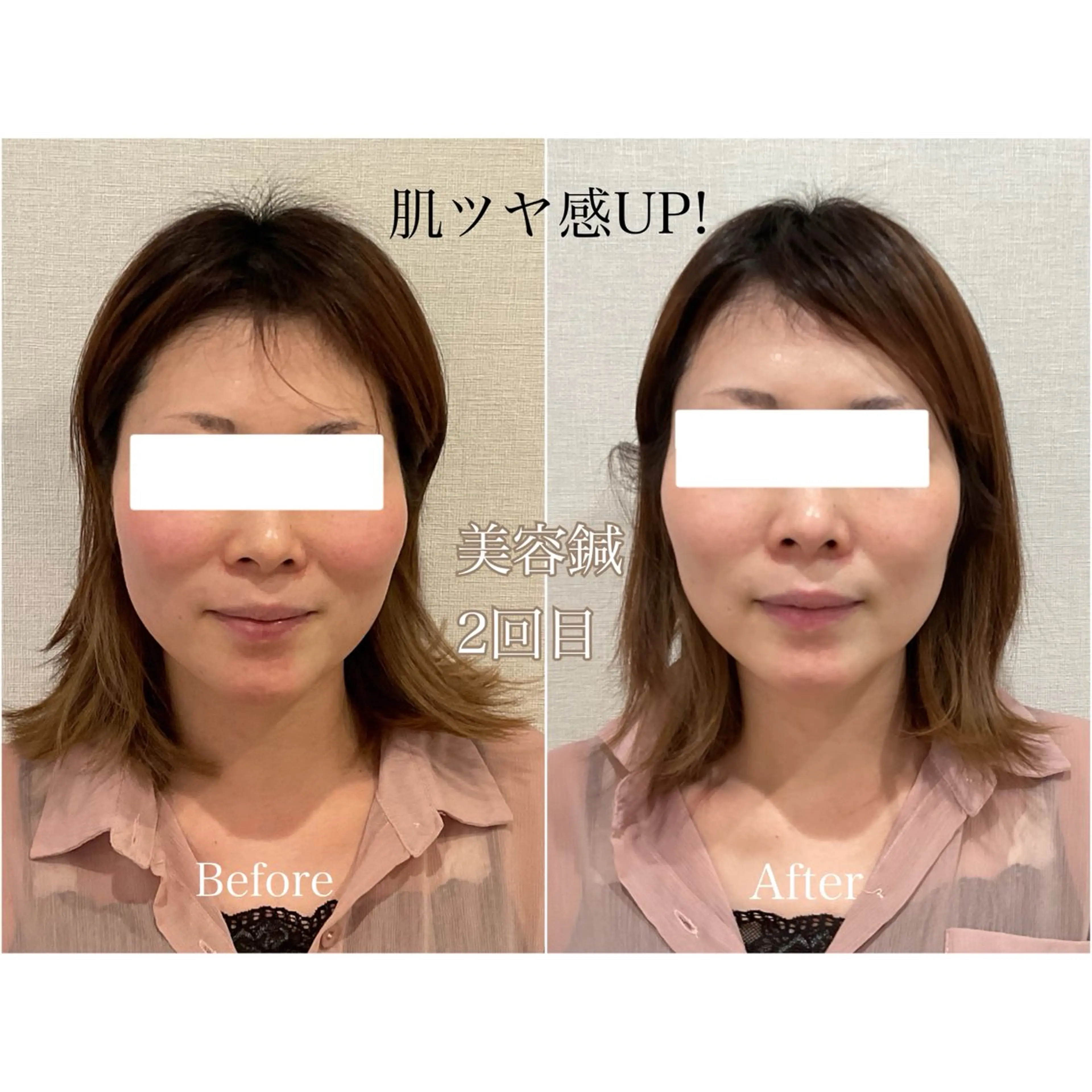 その他 けい整骨院 鍼灸院のその他イメージ