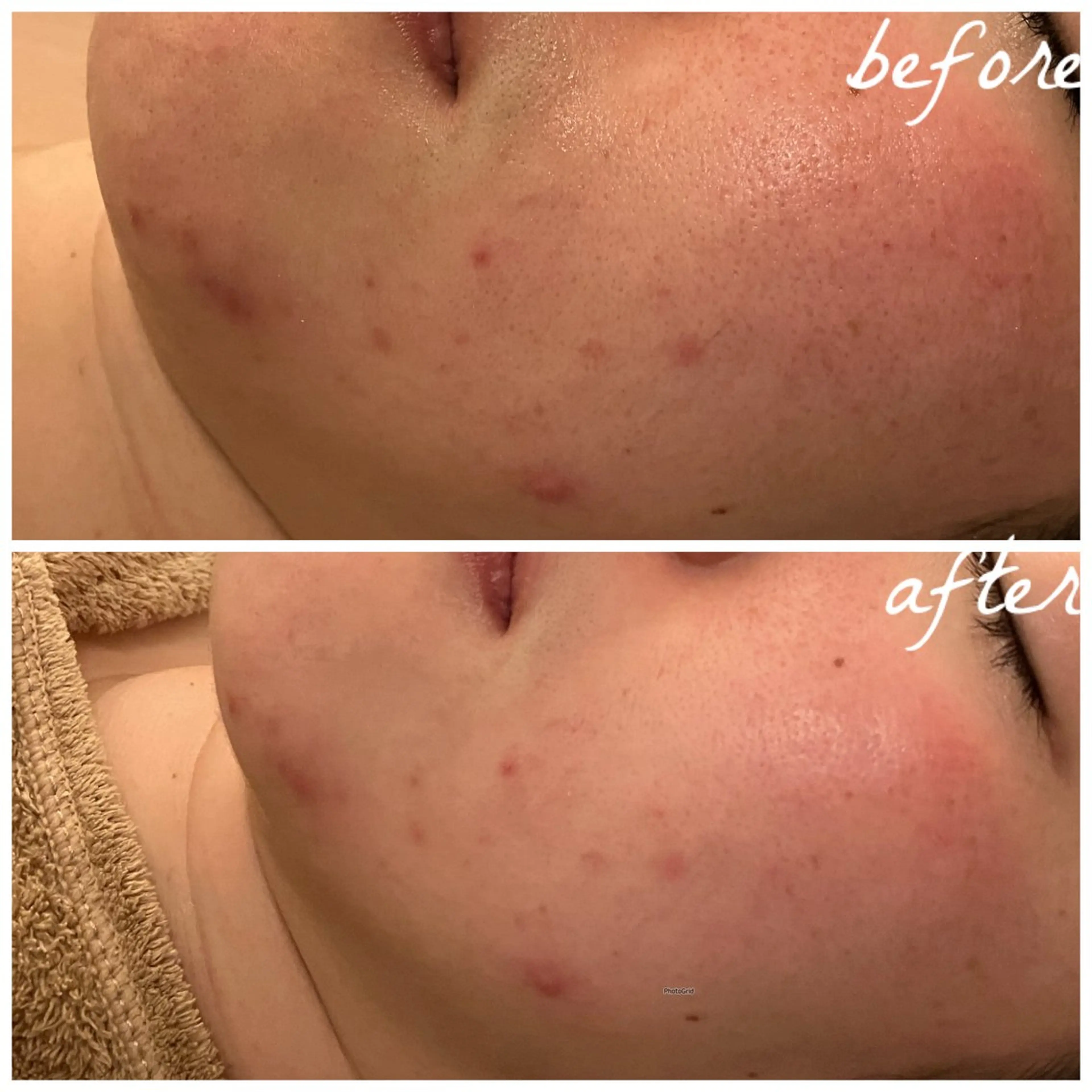 メンズ メナード岐阜茜部 杉浦のエステ・リラクイメージ