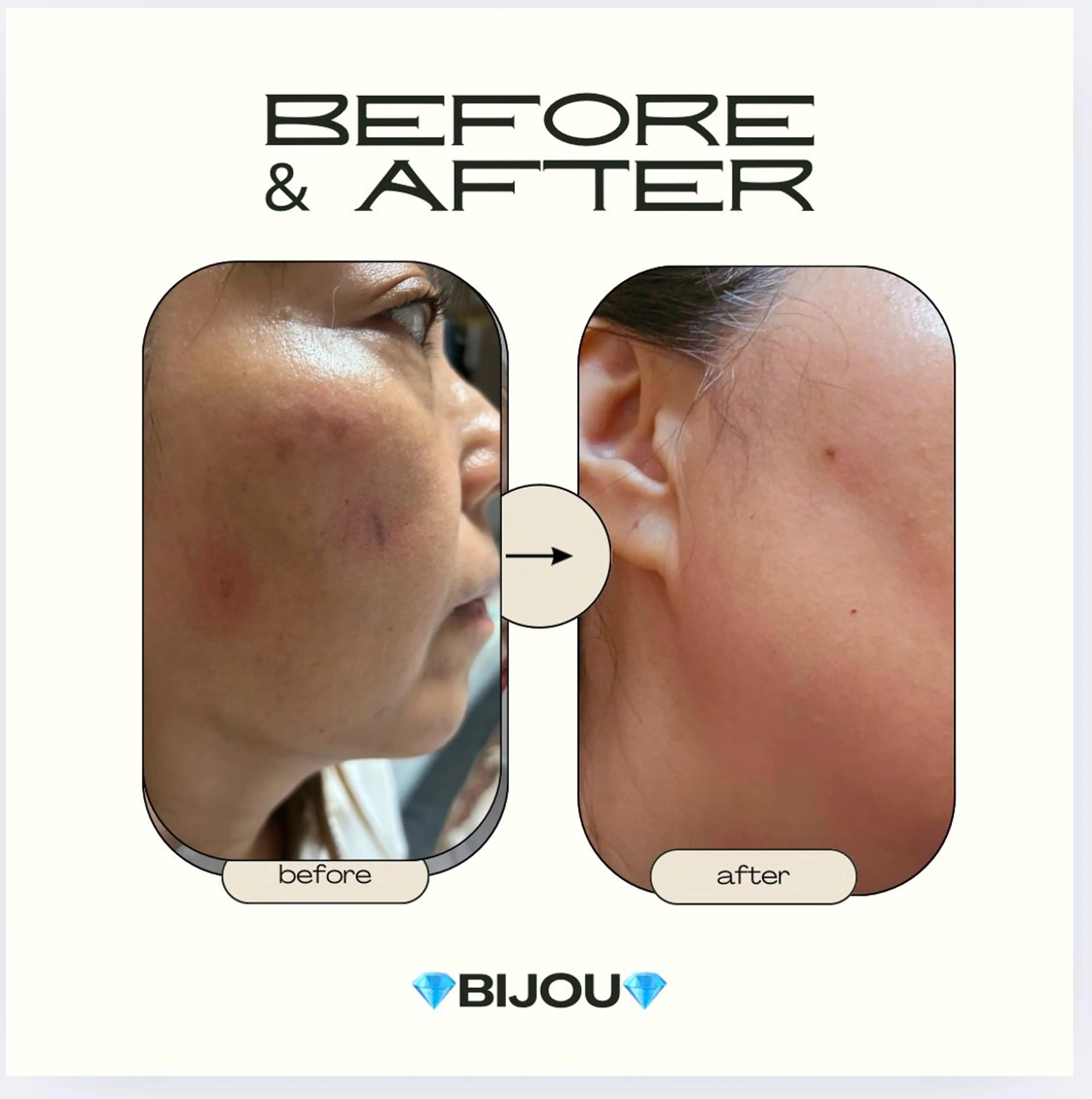 エステ BIJOU八井 美加のエステ・リラクイメージ