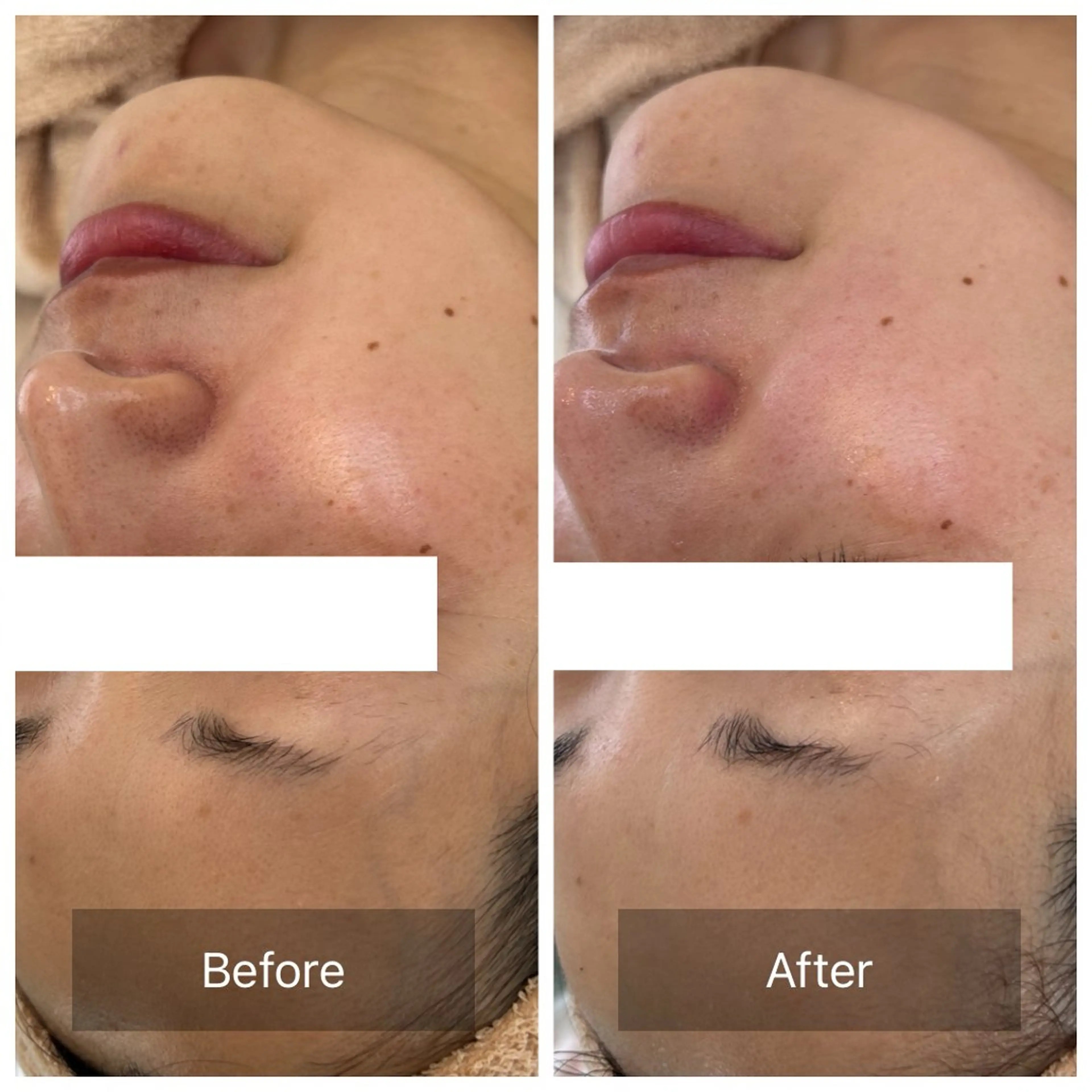 エステ リラク facial aesthetic salon SENTEUR所属・美肌改善/毛穴/シミ サントゥールのエステ・リラクイメージ