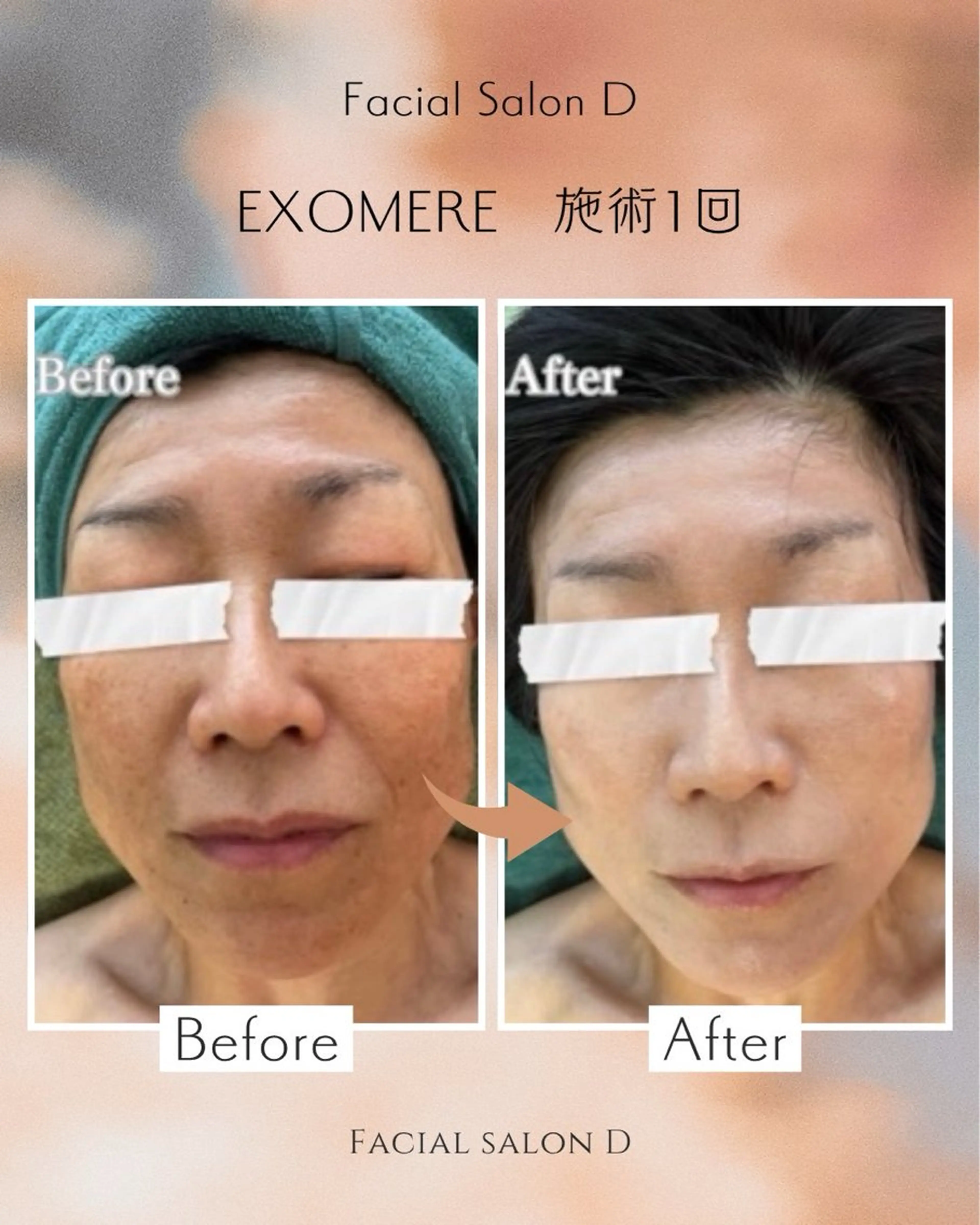 エステ リラク facial salon D 吉沢のエステ・リラクイメージ