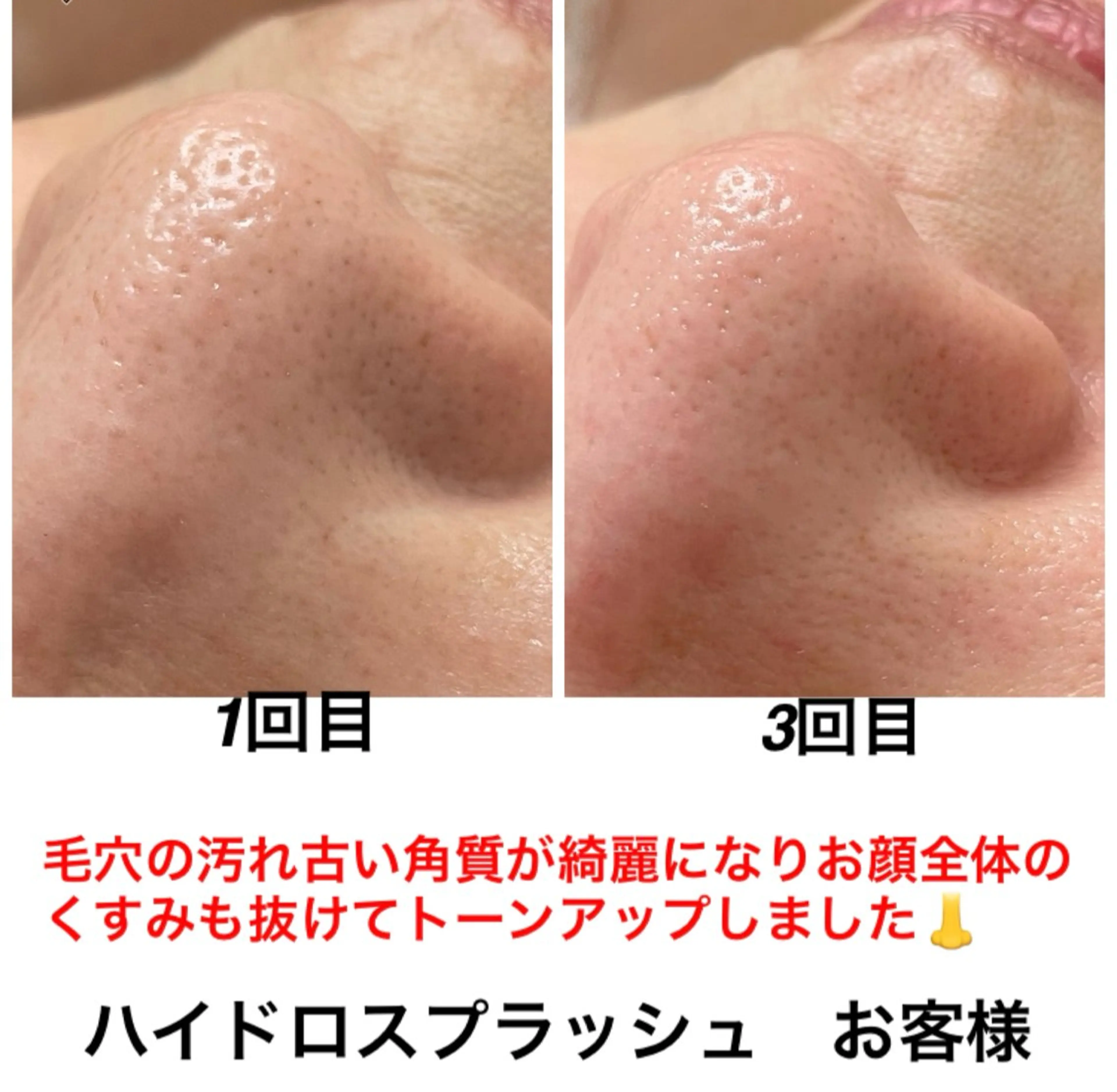 エステ リラク ネイル・エステサロンUILANI所属・ネイル・エステサロン UILANIのネイルデザイン