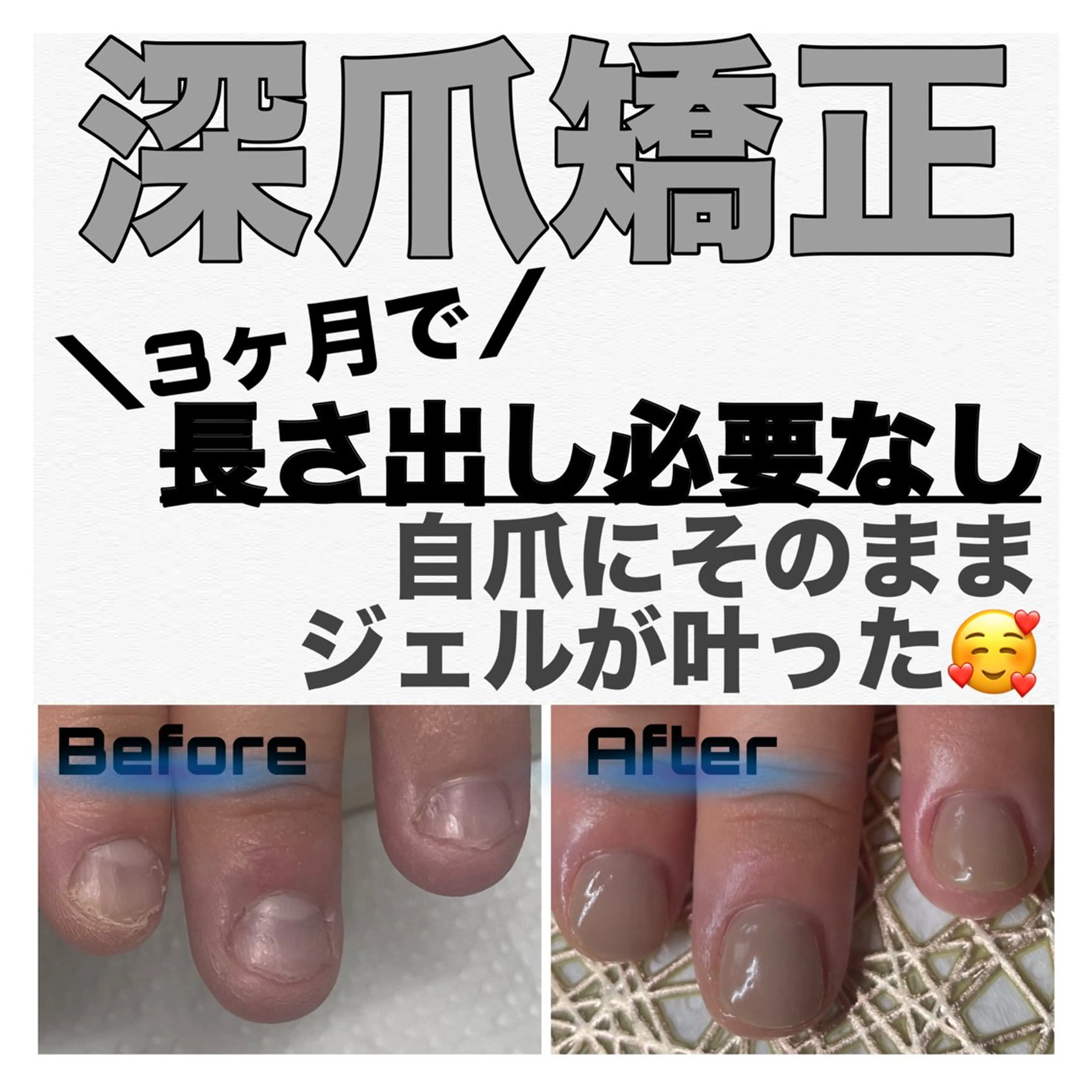 ネイル ピンク ハンドネイル ハンドケア nail salon petillantのネイルデザイン