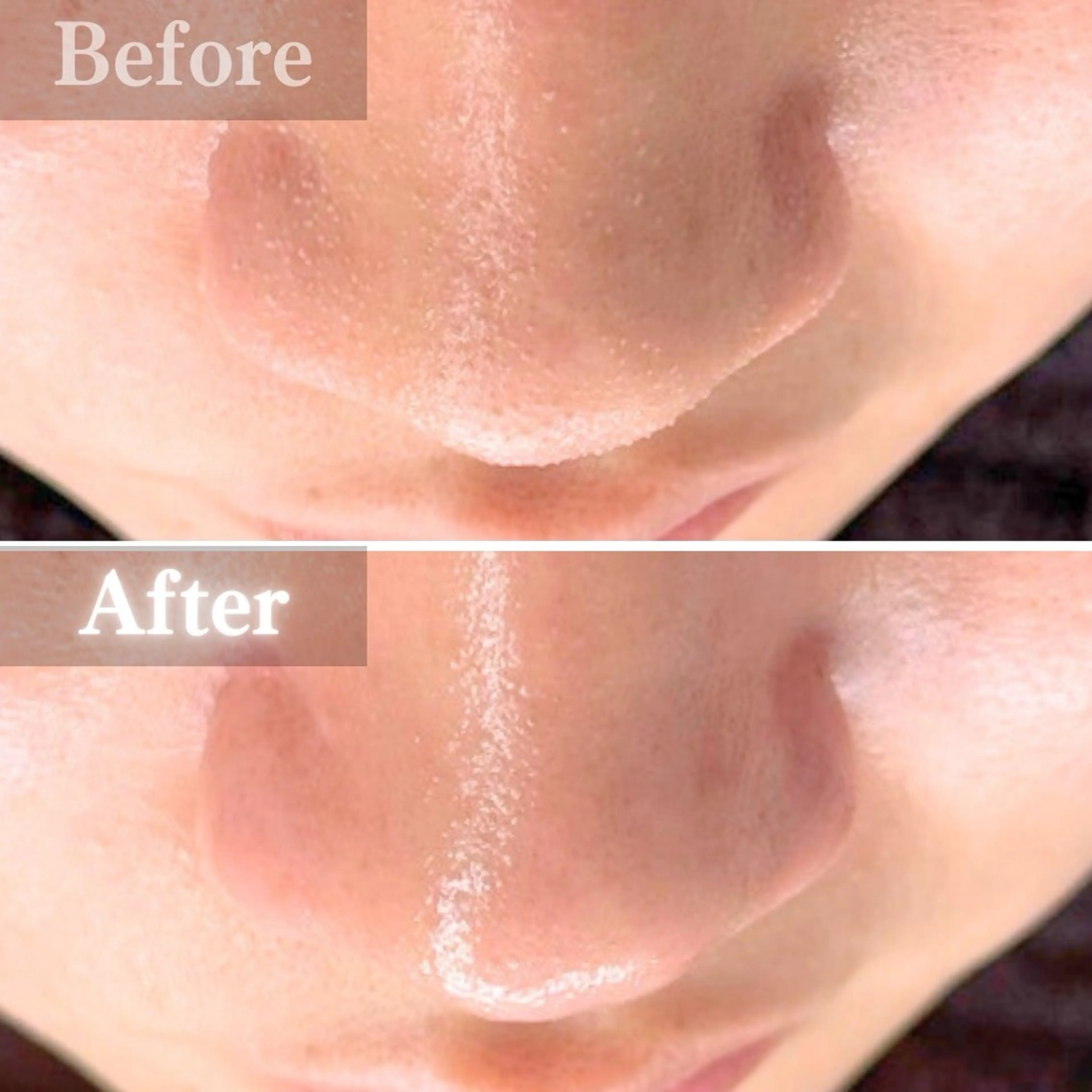 エステ 毛穴洗浄特化🫧 オオツカのエステ・リラクイメージ