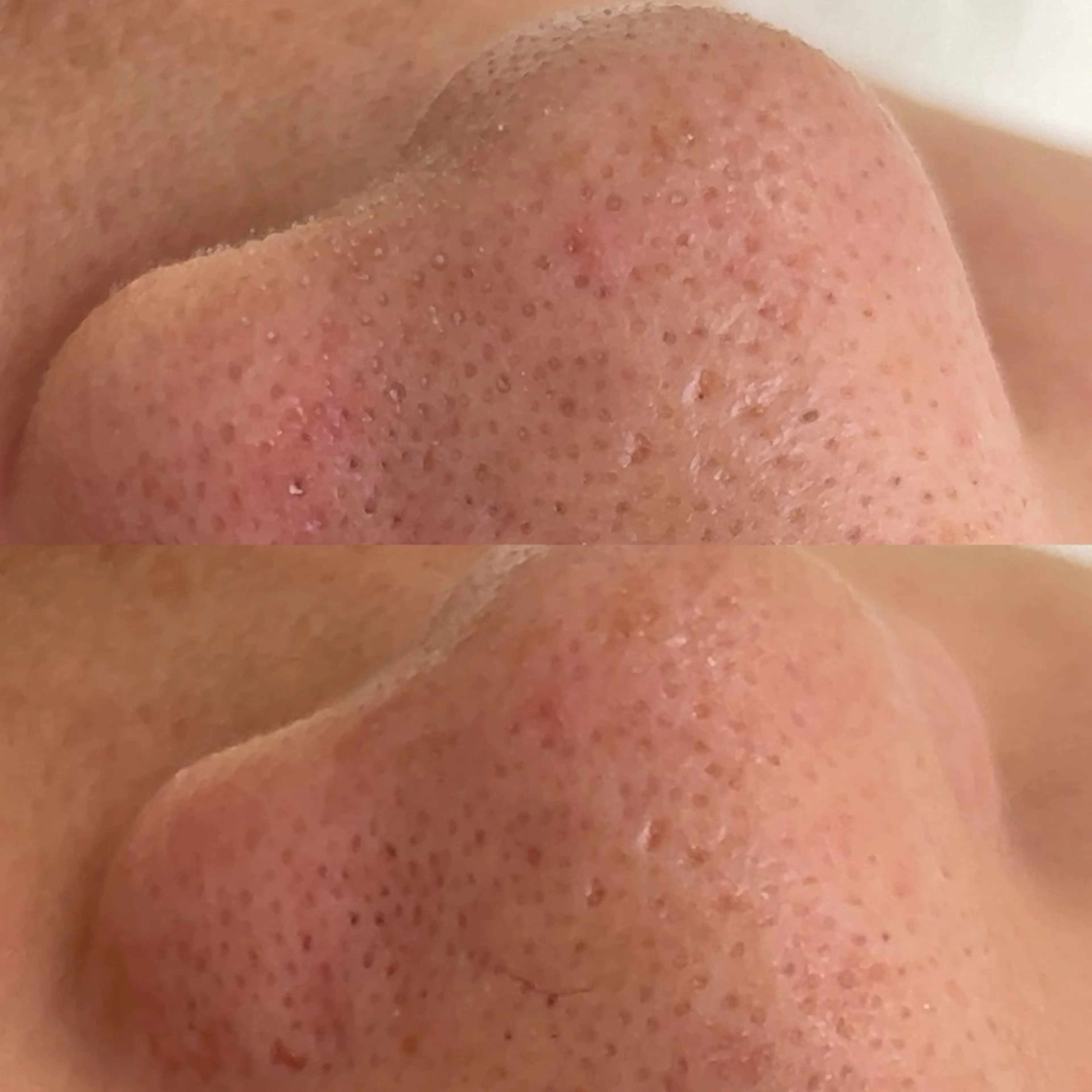 エステ 美肌育成専門サロンラクシュミー所属・毛穴肌管理サロン ラクシュミーのエステ・リラクイメージ