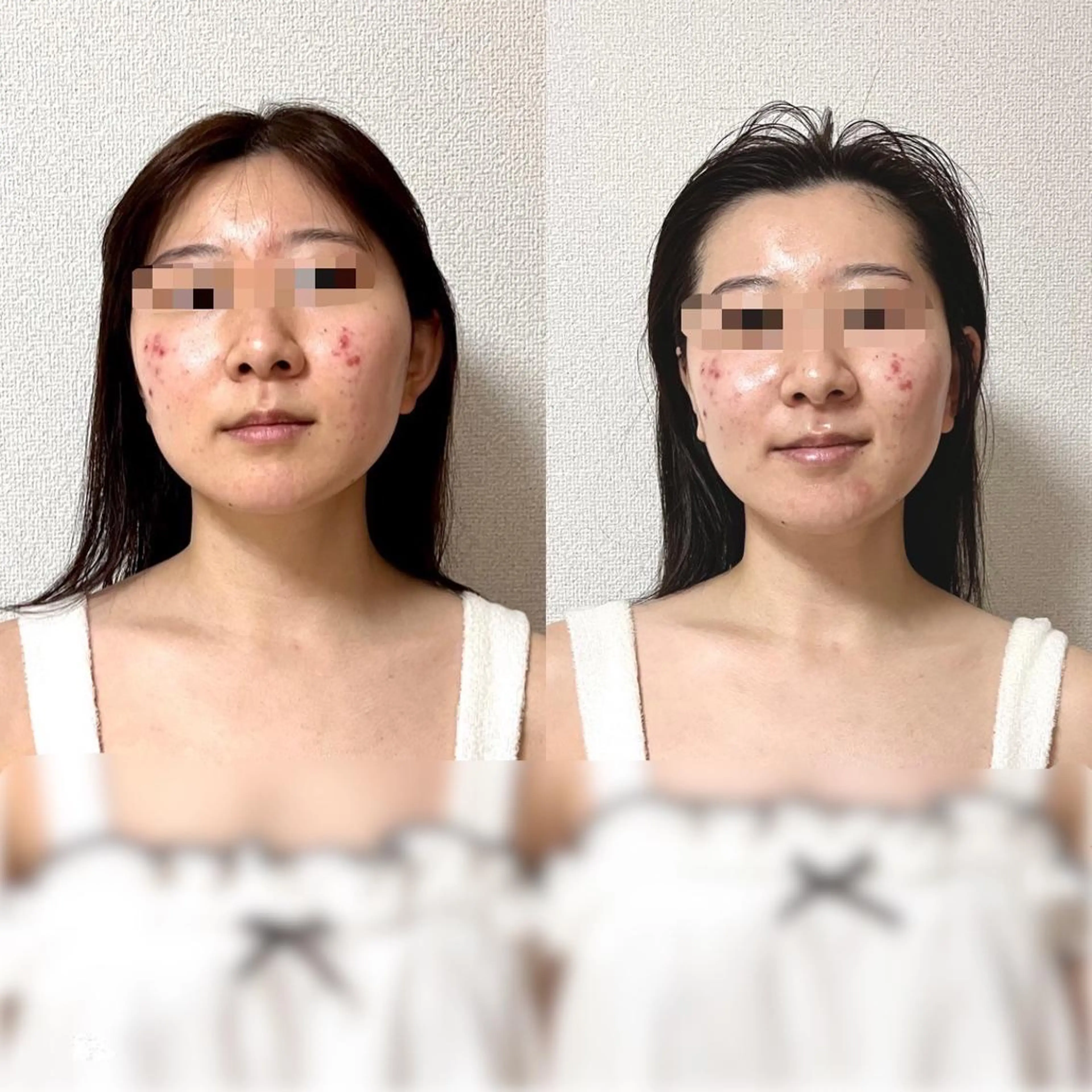 カラダとココロ 癒されほっと一息のエステ・リラクイメージ