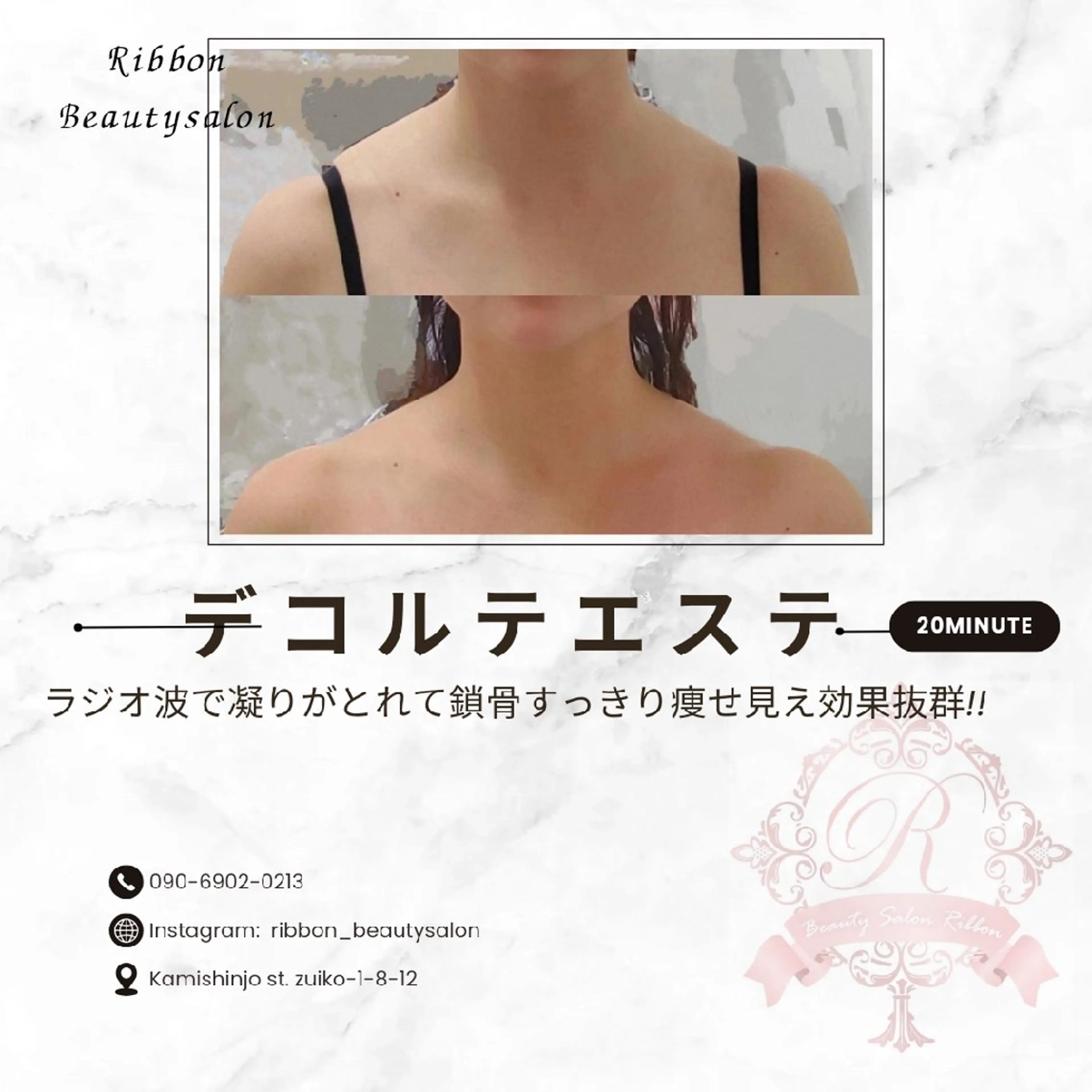 鎖骨出しデコルテラジオ波エステ♡20分♡口コミ必須メニューの写真