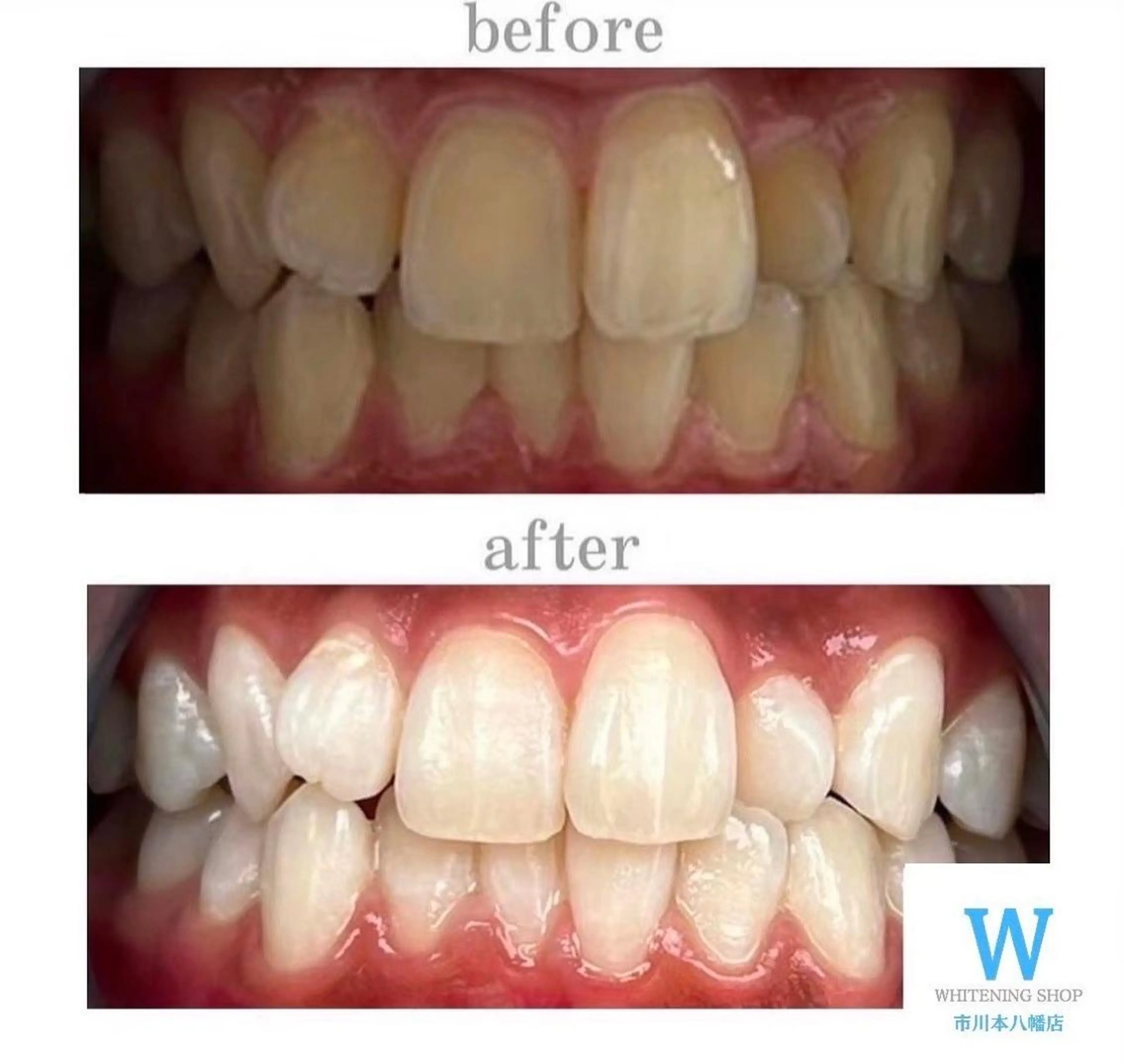 ホワイトニング ショップ本八幡店のエステ・リラクイメージ