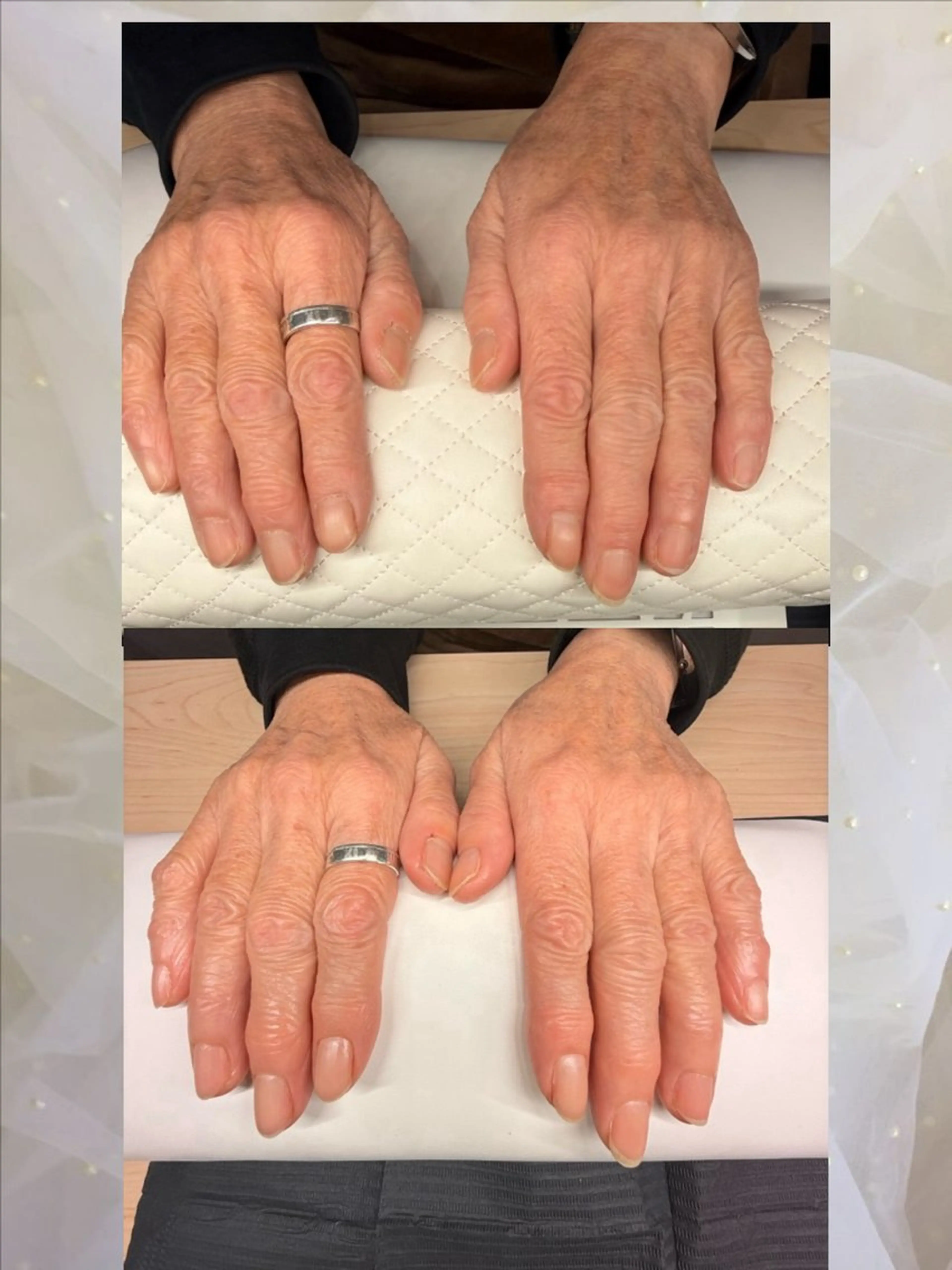 ネイル nailist Minaのネイルデザイン