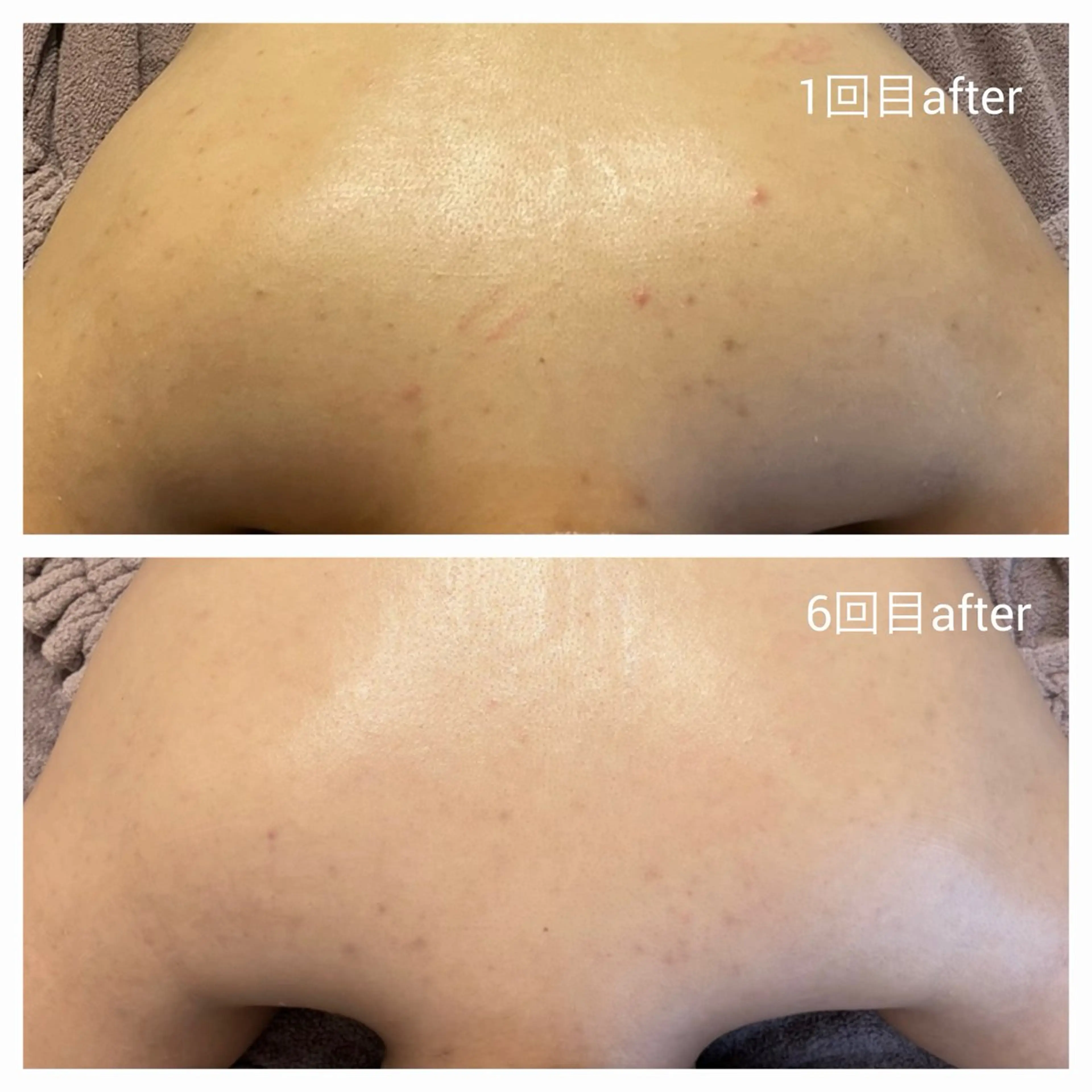 ハーブピーリング ミヌ心斎橋のエステ・リラクイメージ