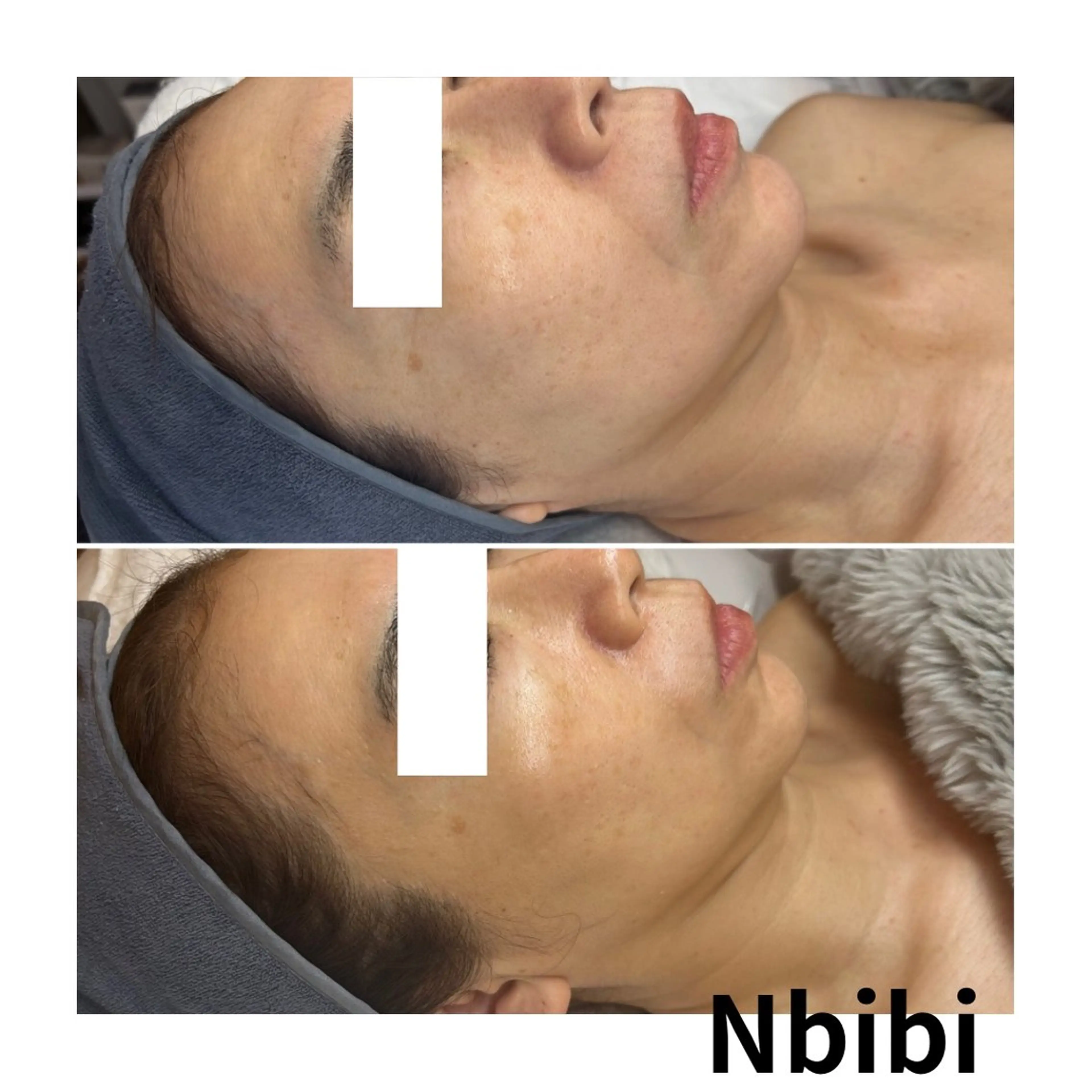 エステ 韓国🇰🇷価格 サロン_Nbibiの眉毛・アイブロウイメージ