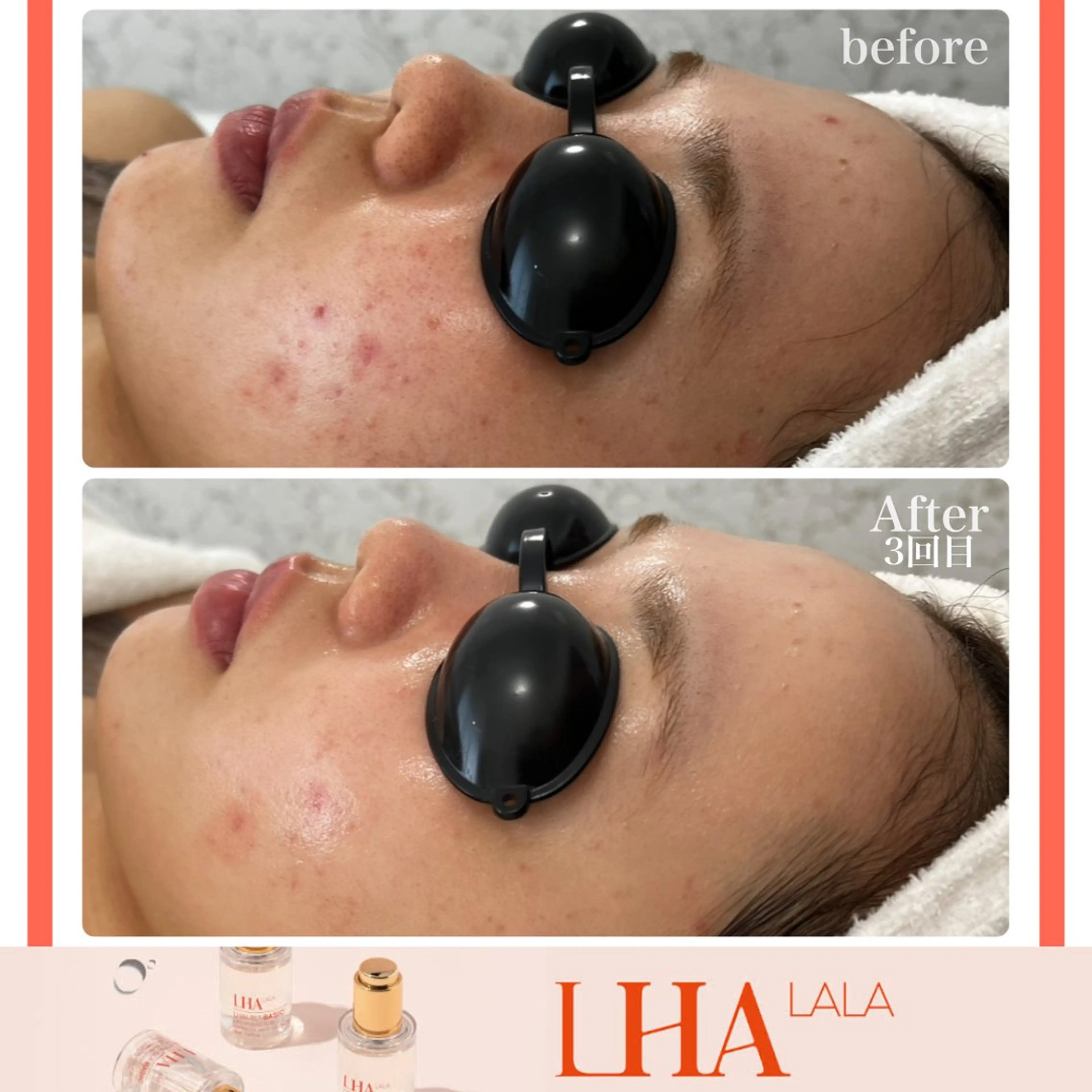 LiAm《美肌管理/ 小顔/脂肪ケア》のその他イメージ