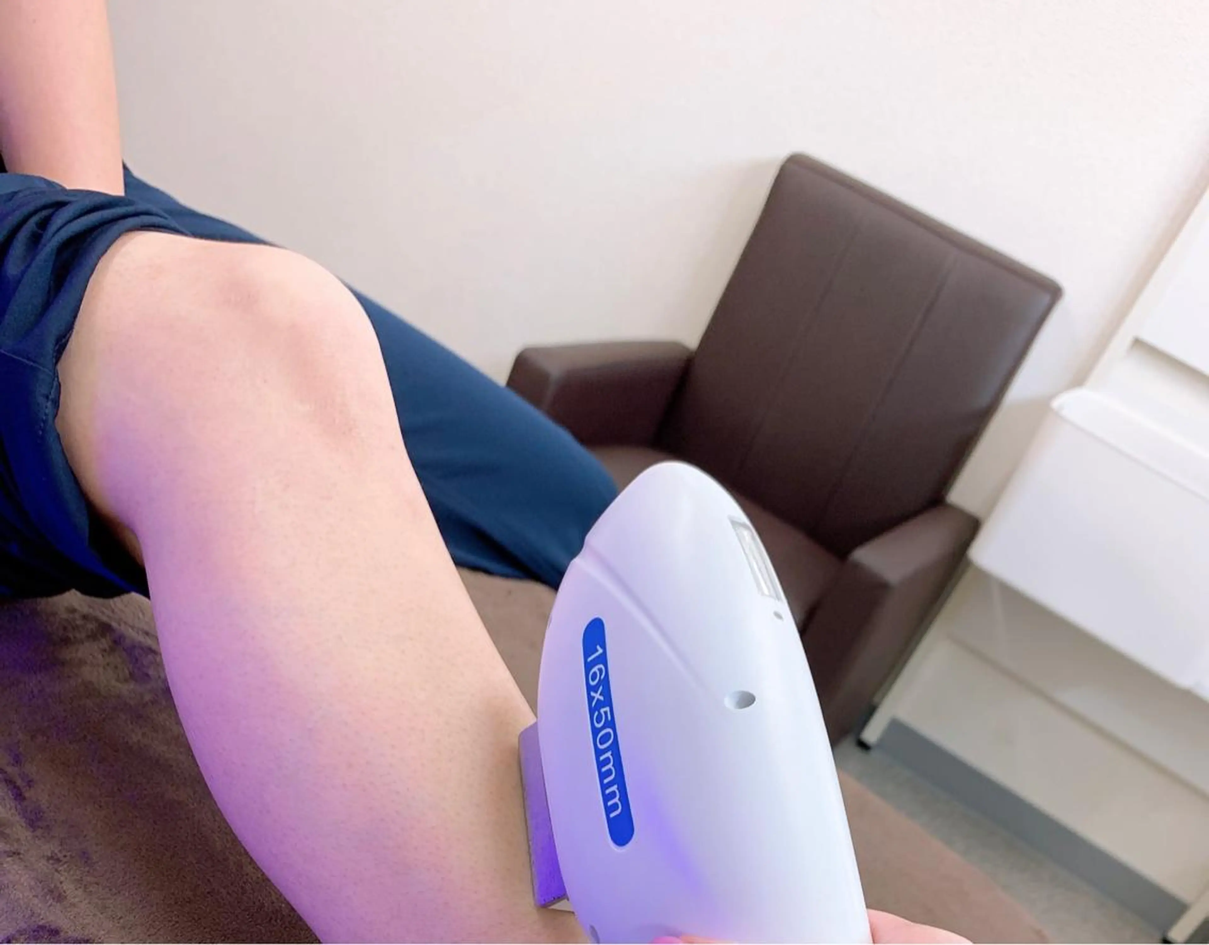 ヒザ下脱毛の写真