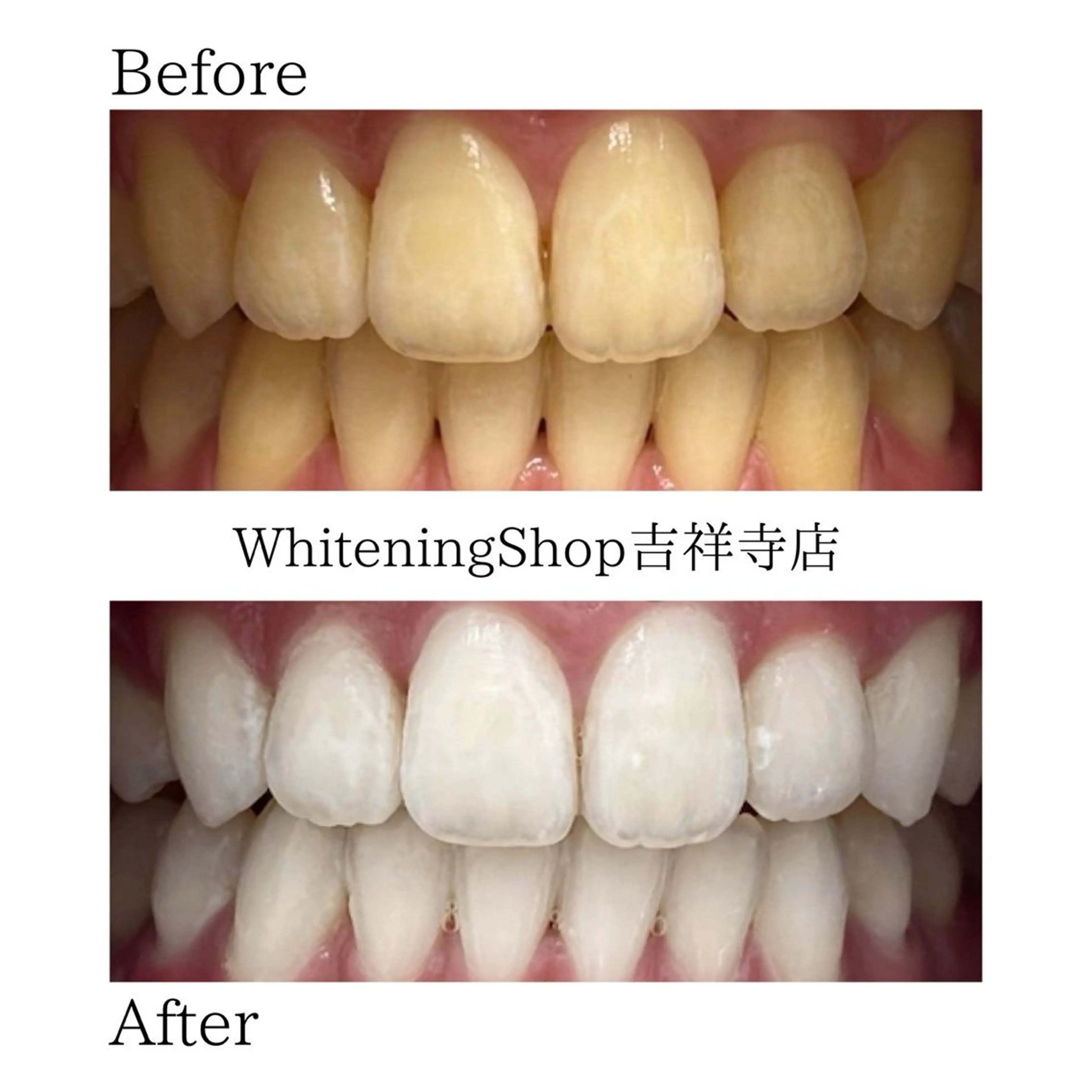 エステ リラク ホワイトニング ショップ吉祥寺店のエステ・リラクイメージ