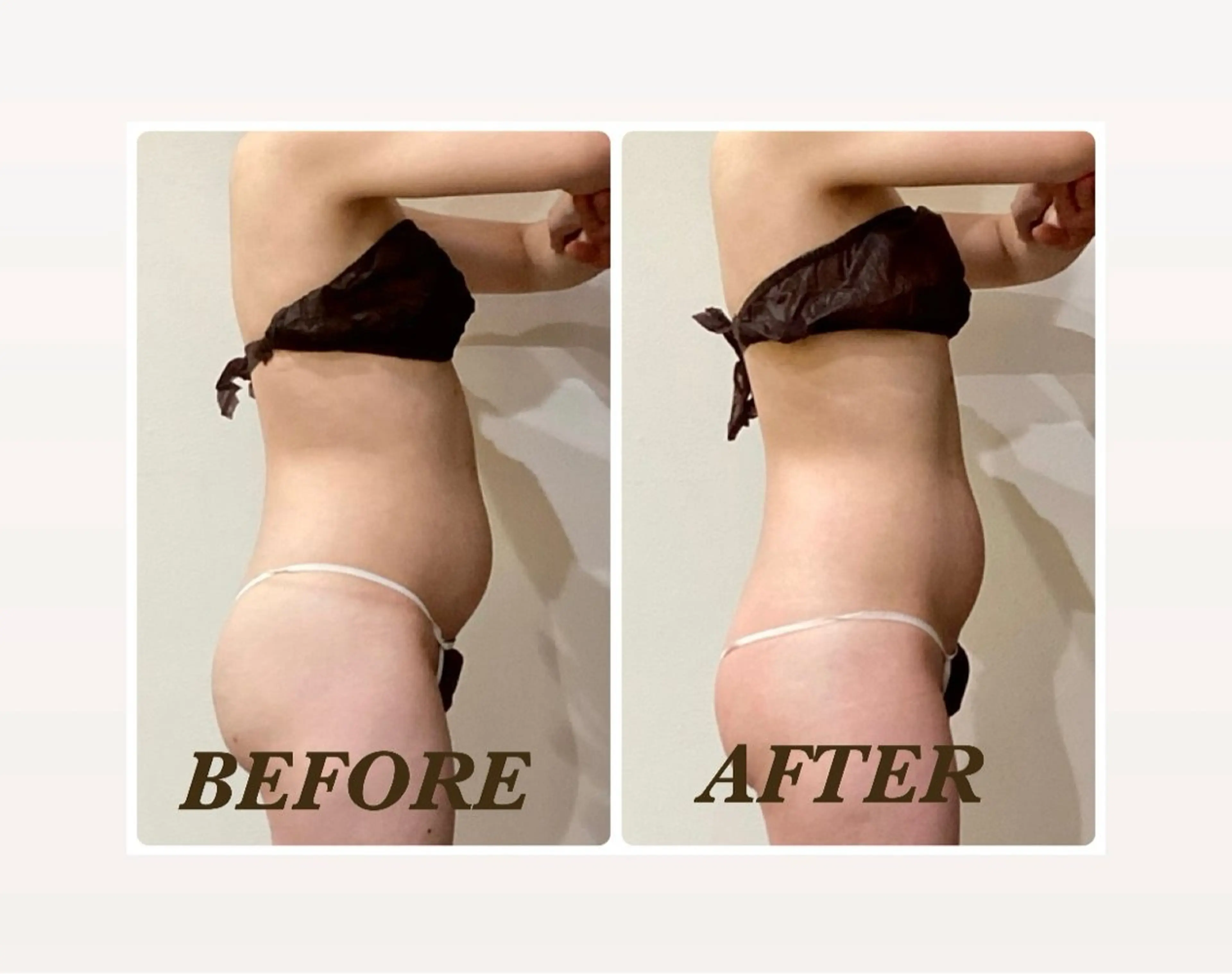 エステ リラク Prima 痩身脱毛 にごうかおりのエステ・リラクイメージ