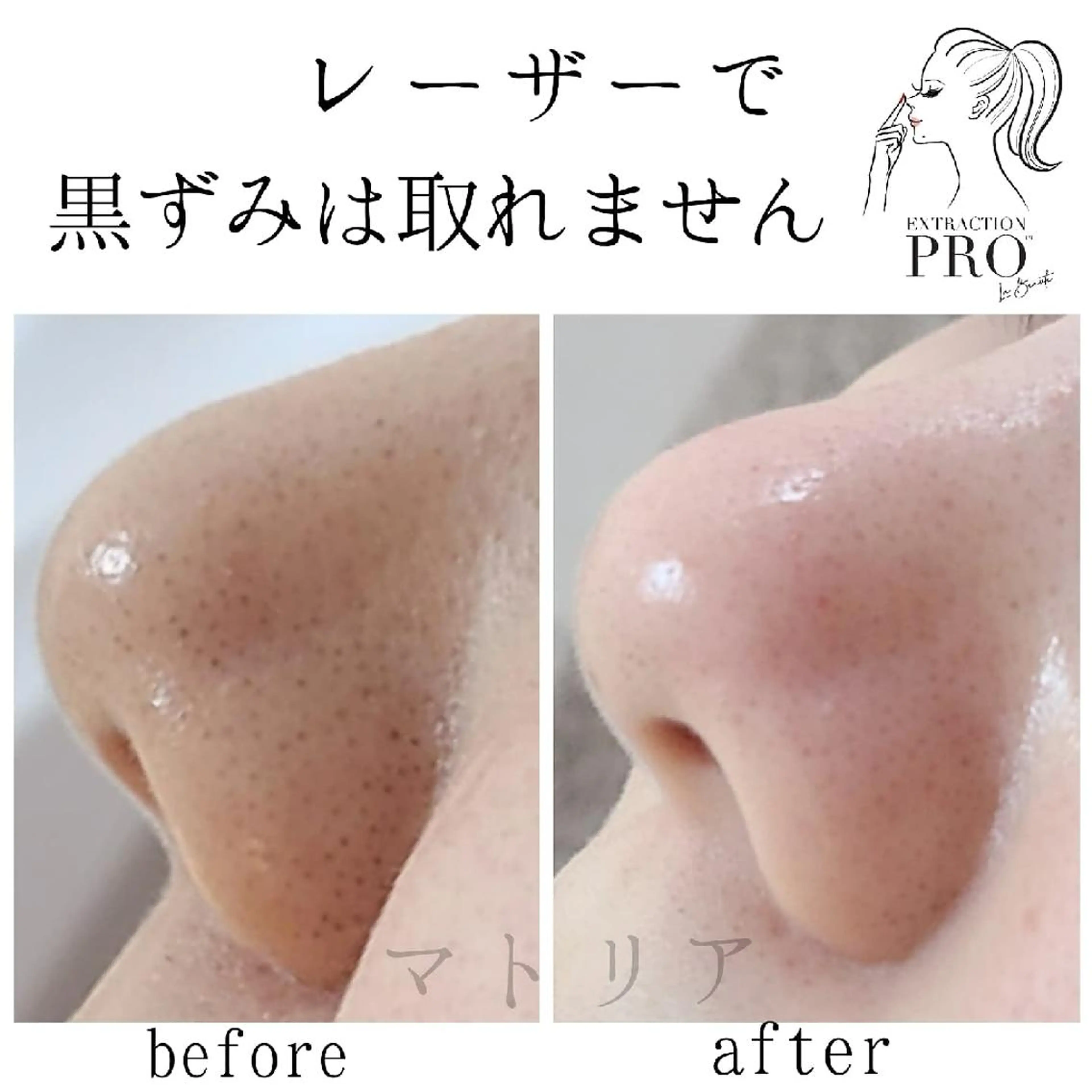 エステ 小顔 美肌専門 Matoriaのエステ・リラクイメージ