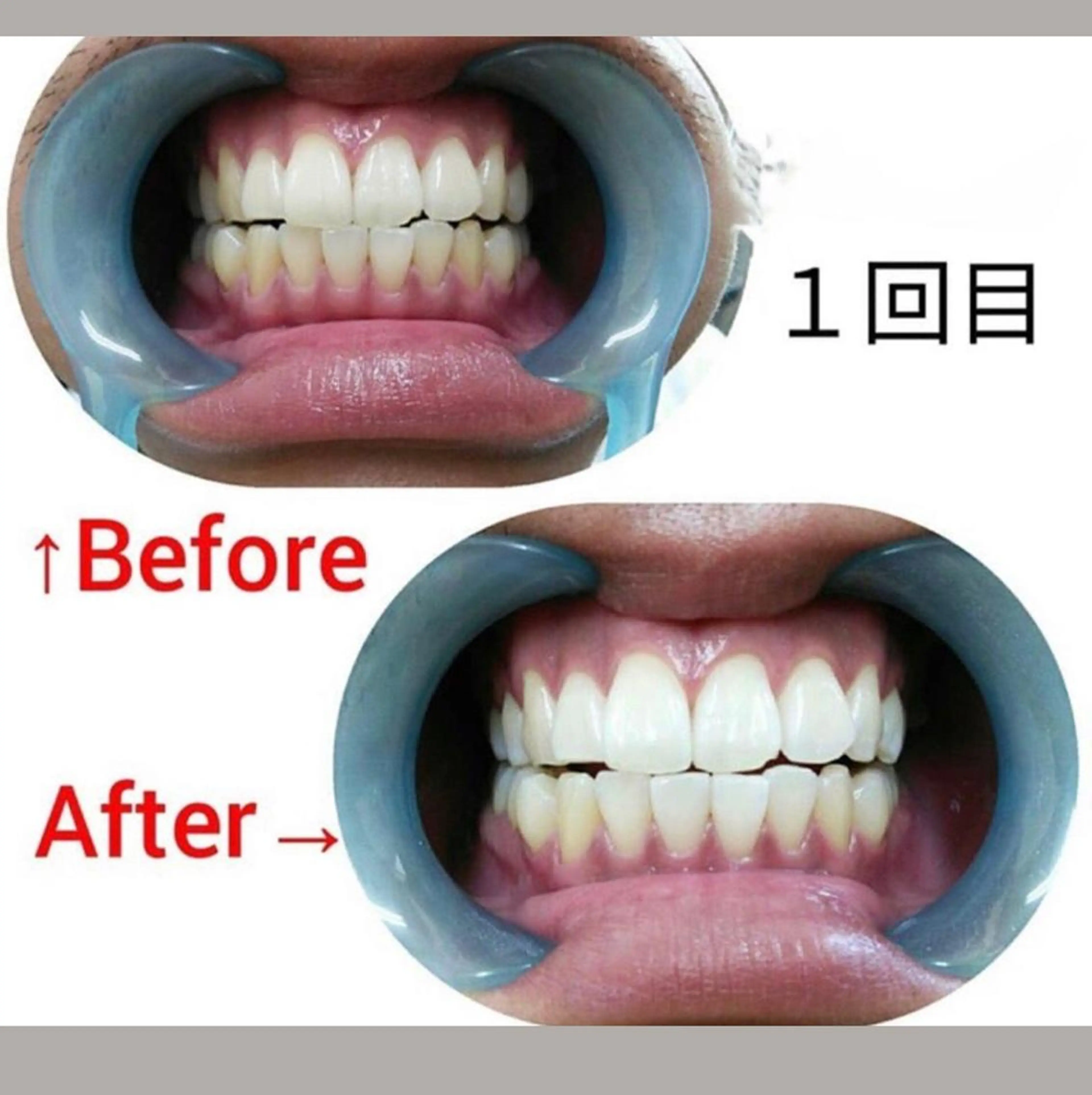 M渋谷 ホワイトニングのエステ・リラクイメージ