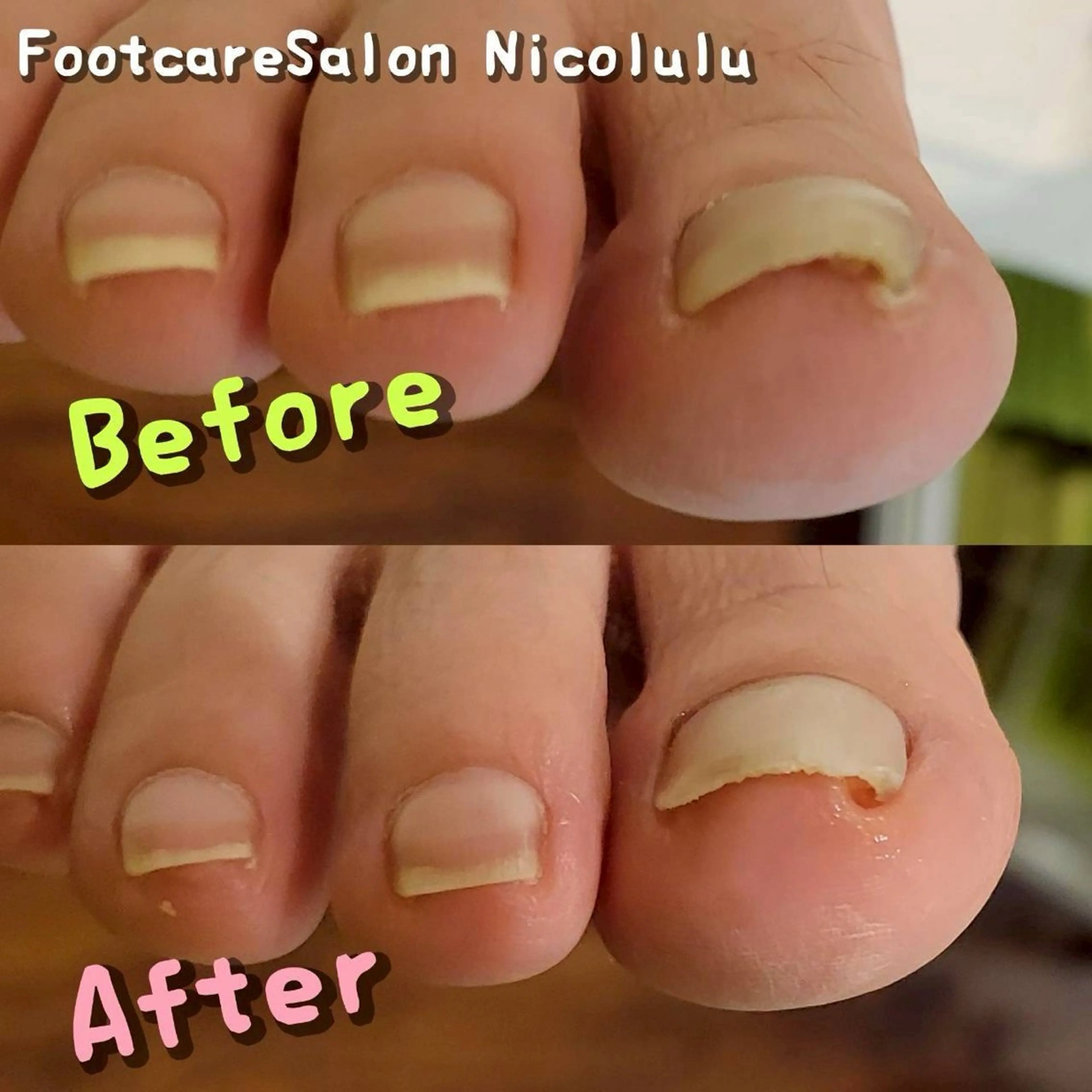 リラク 足トラブル専門 ニコルル金沢のエステ・リラクイメージ