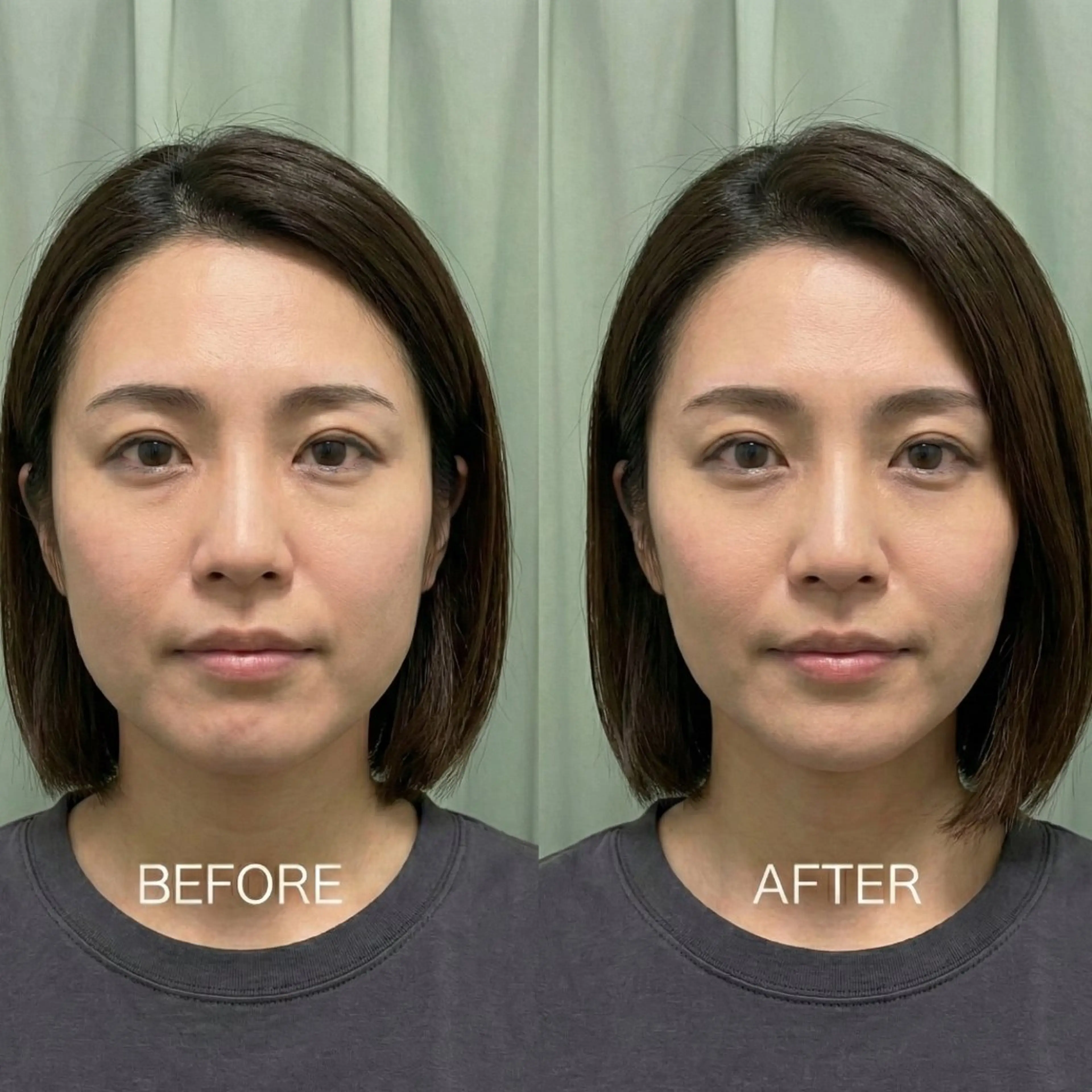 美容鍼DAZZLE マスザキのエステ・リラクイメージ