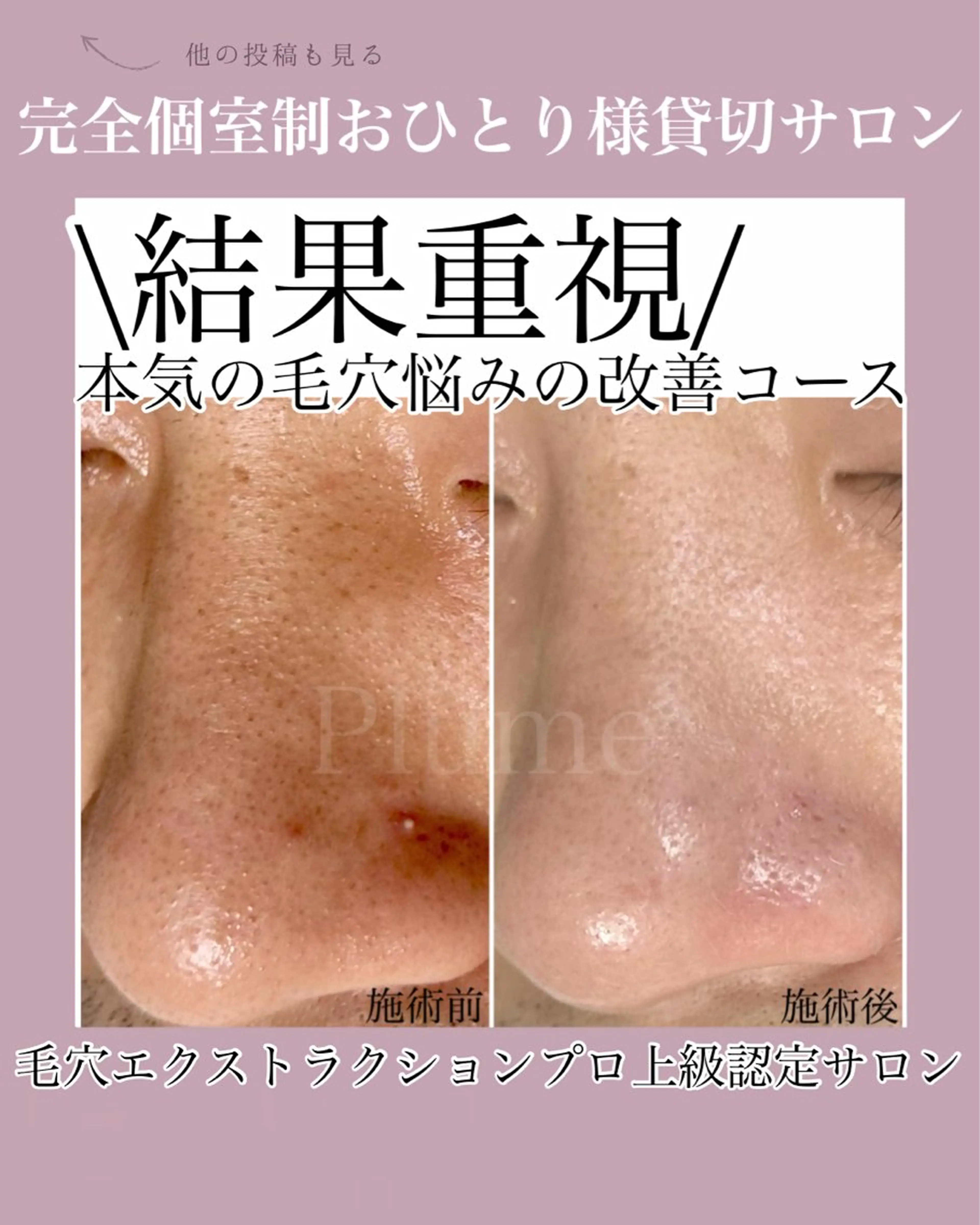 まつ毛、毛穴ケア 専門サロンPlumeのマツエク・マツパデザイン