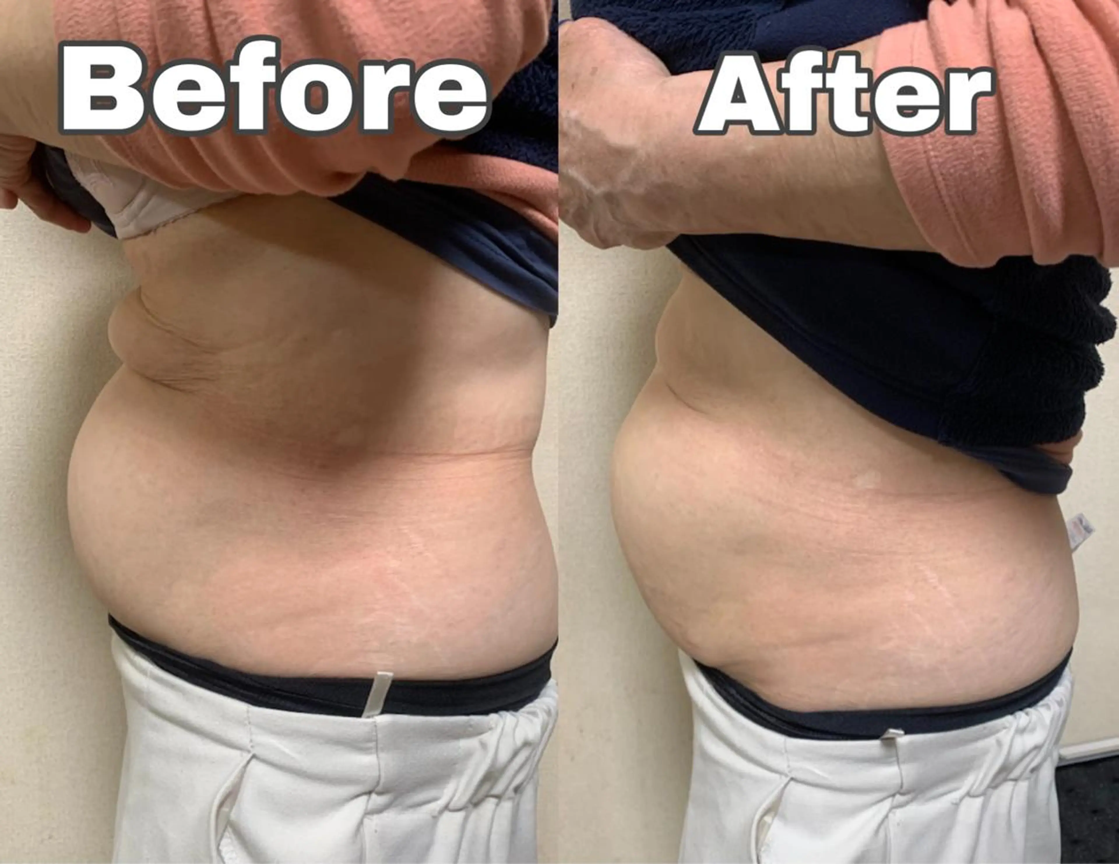 エステ 藤本 真心のネイルデザイン