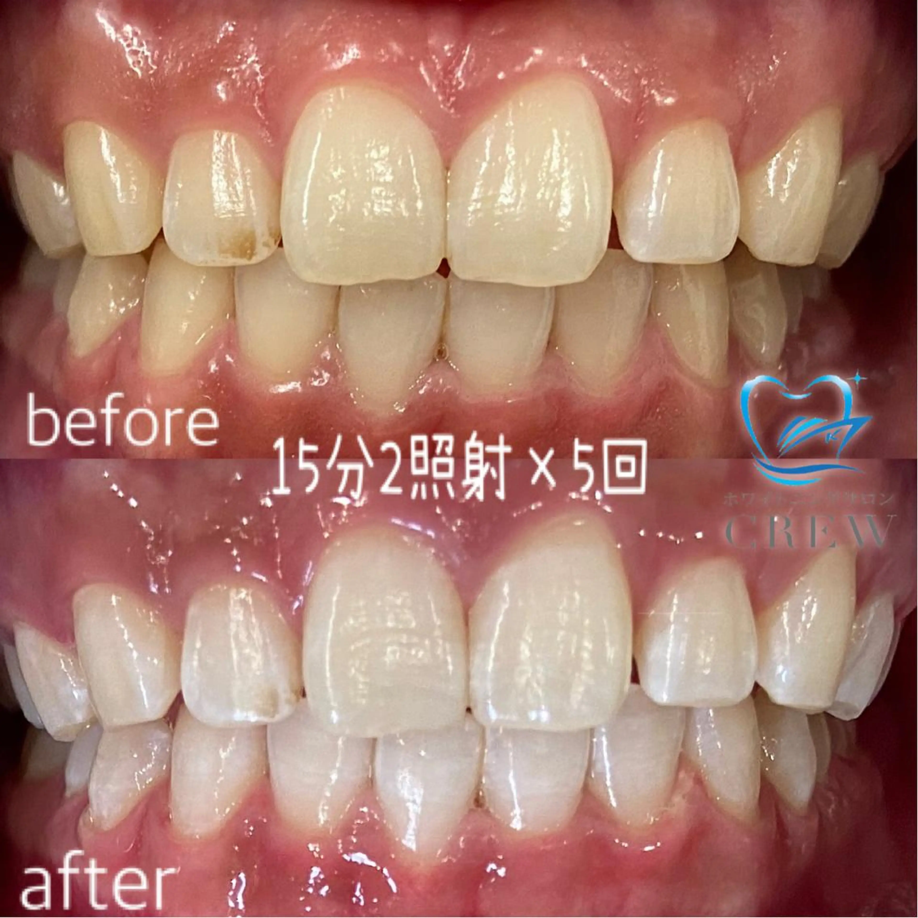 カラー メンズ ネイル マツエク・マツパ アイブロウ その他 ホワイトニングサロン CREWのその他イメージ