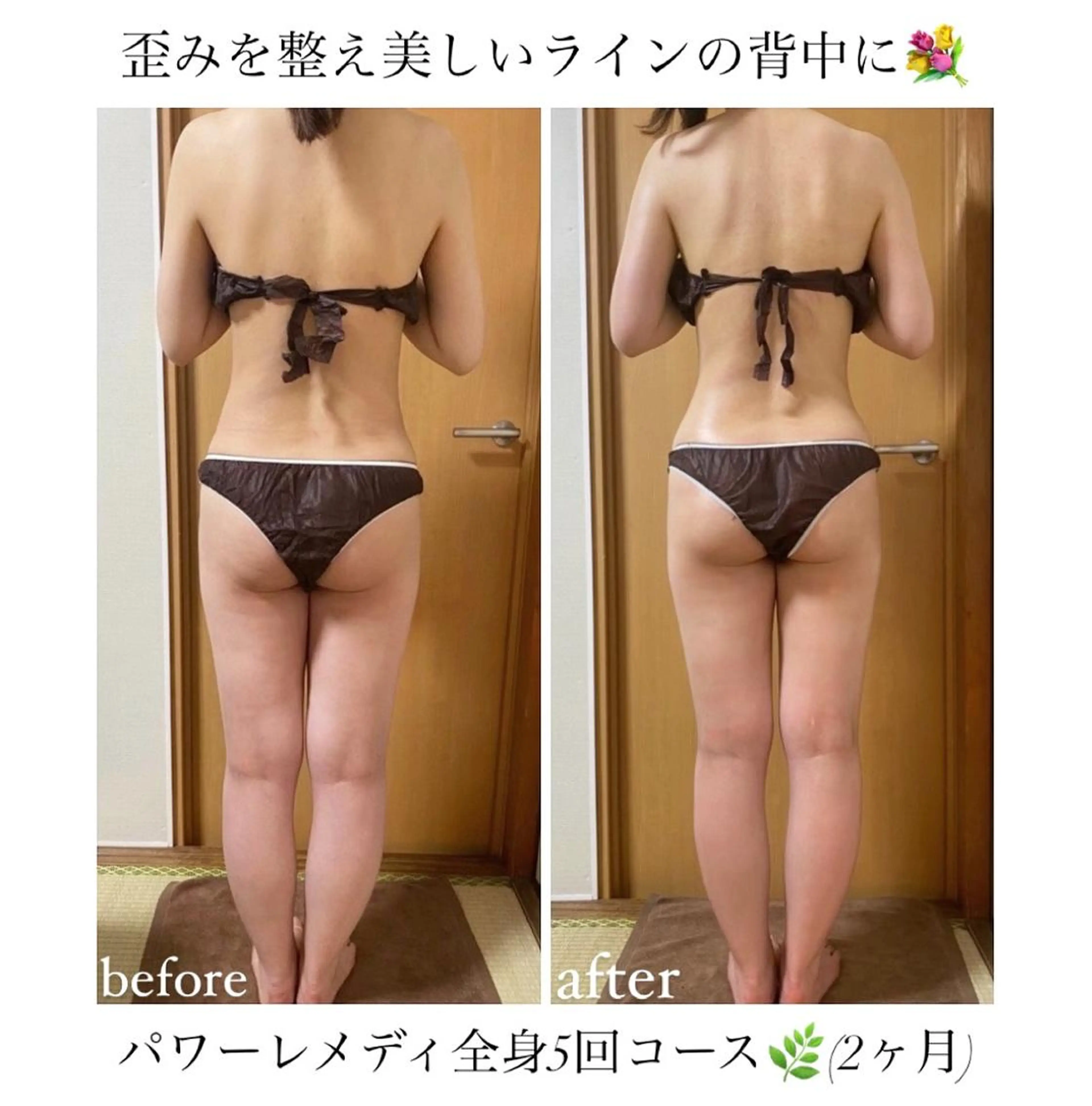 《本気痩せ×疲労改善 》  BILOOPのエステ・リラクイメージ