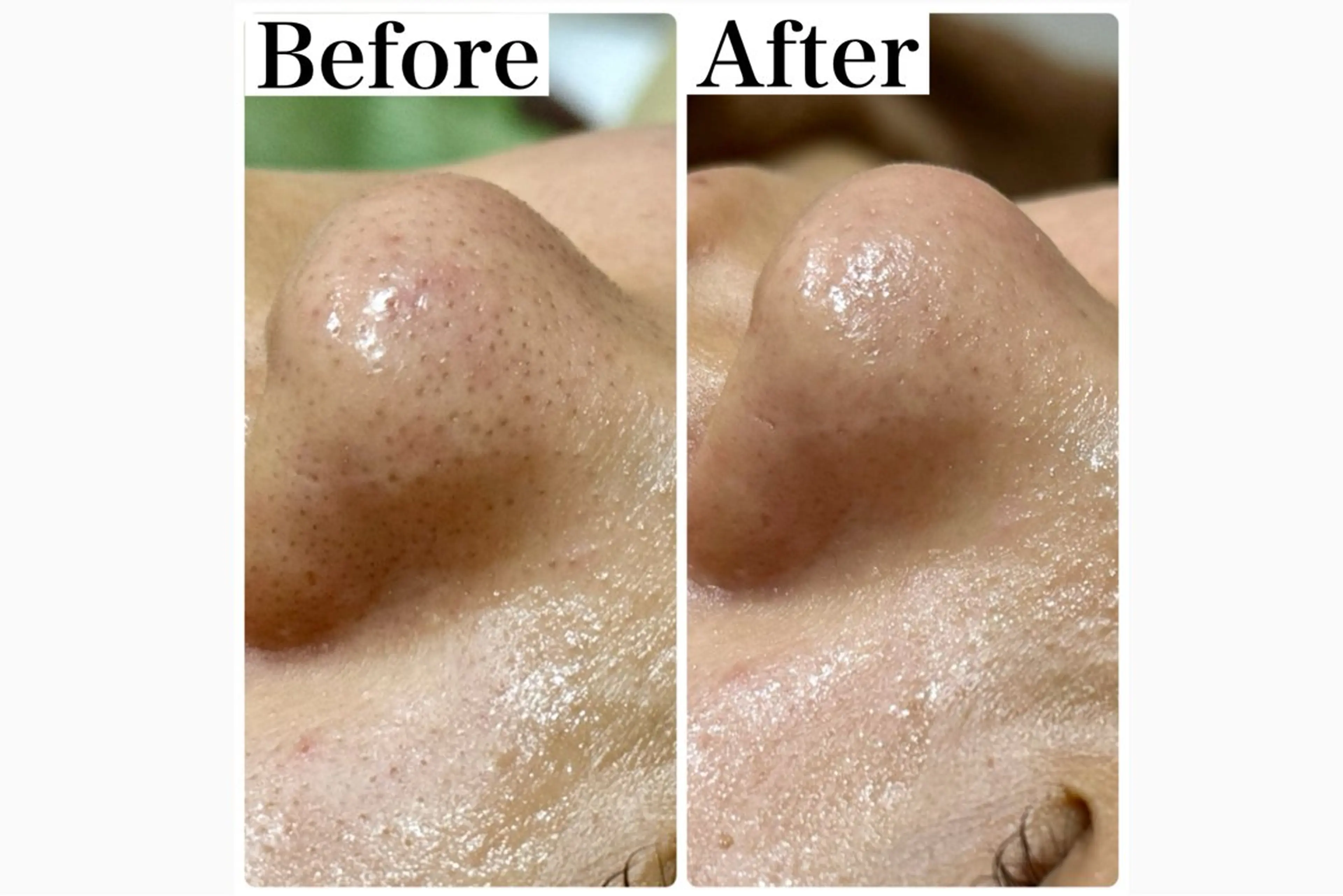 エステ 脱毛&フェイシャル 専門店muro.のエステ・リラクイメージ