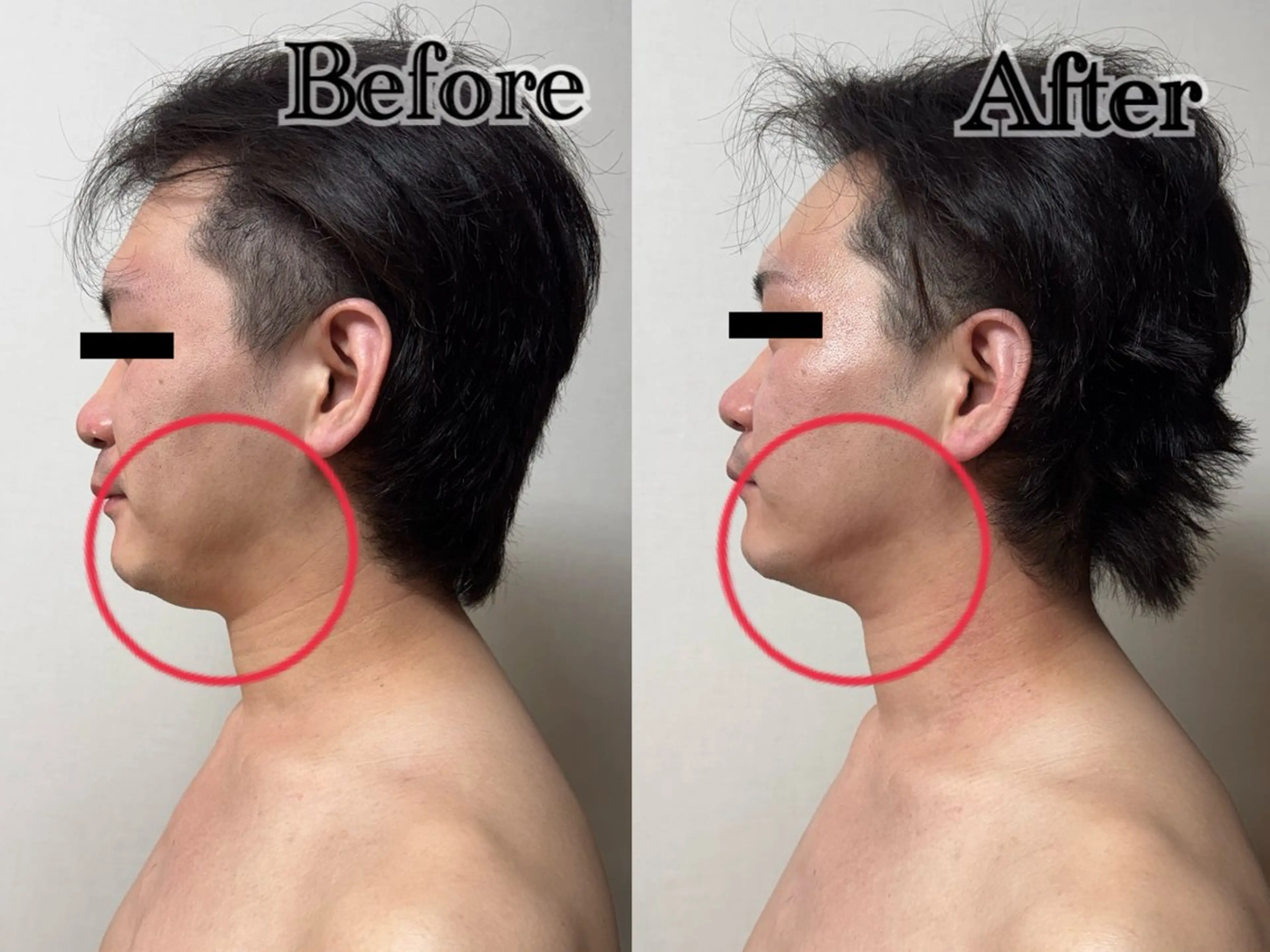 エステ 六本木脱毛andS 店長Sachiのエステ・リラクイメージ